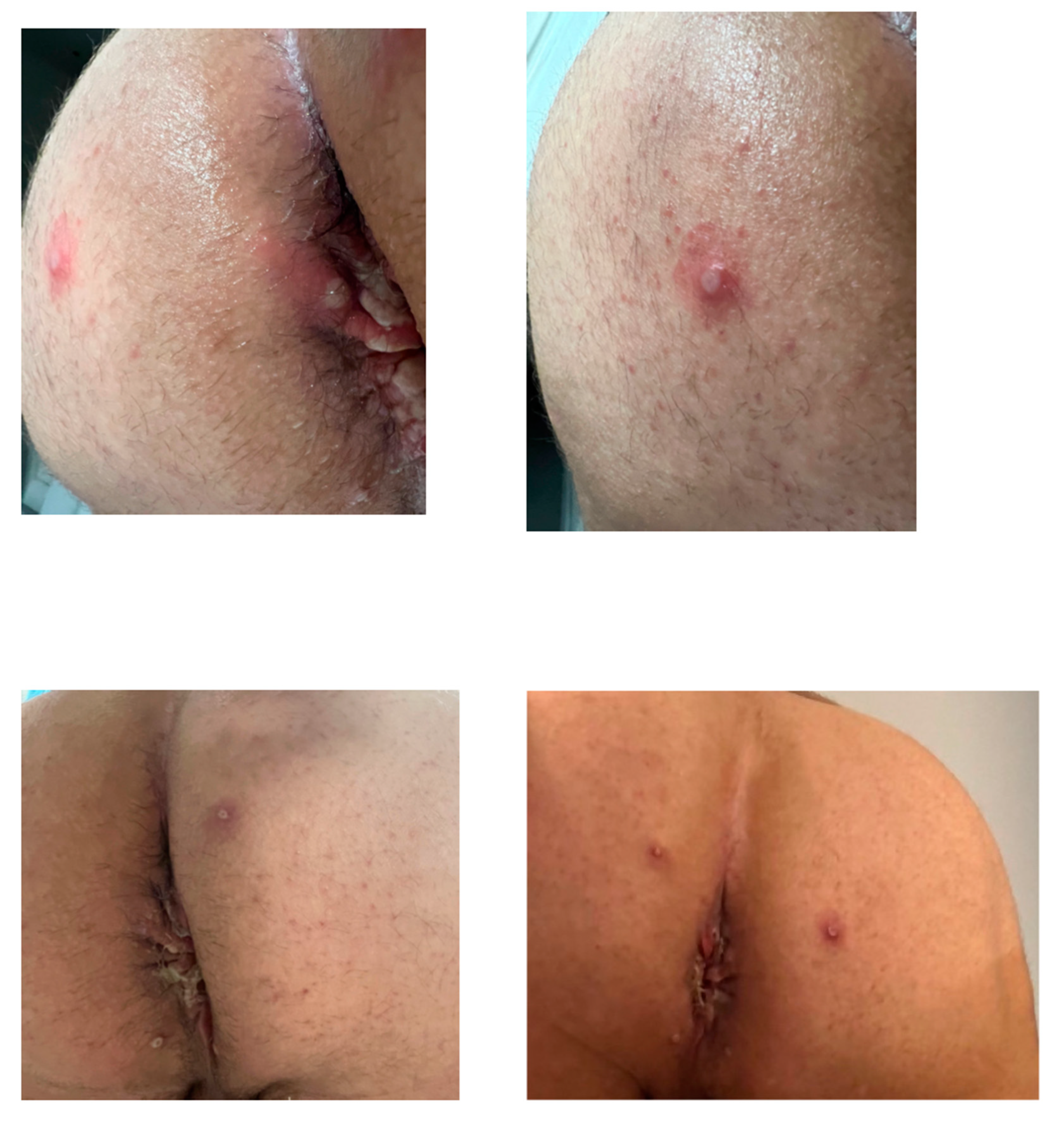 Tropicalmed 08 00015 g001 550