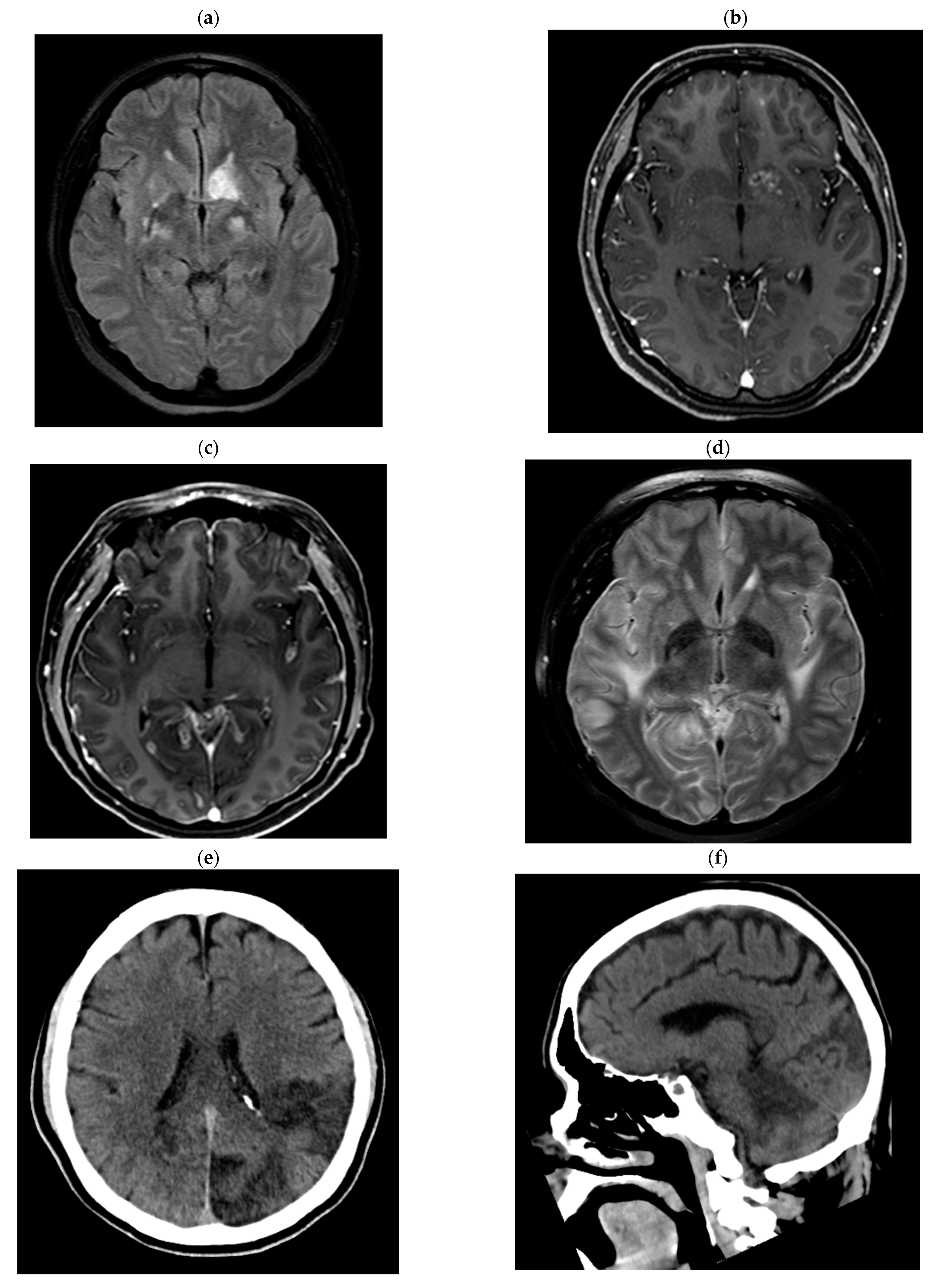 Tropicalmed 08 00182 g001a 550