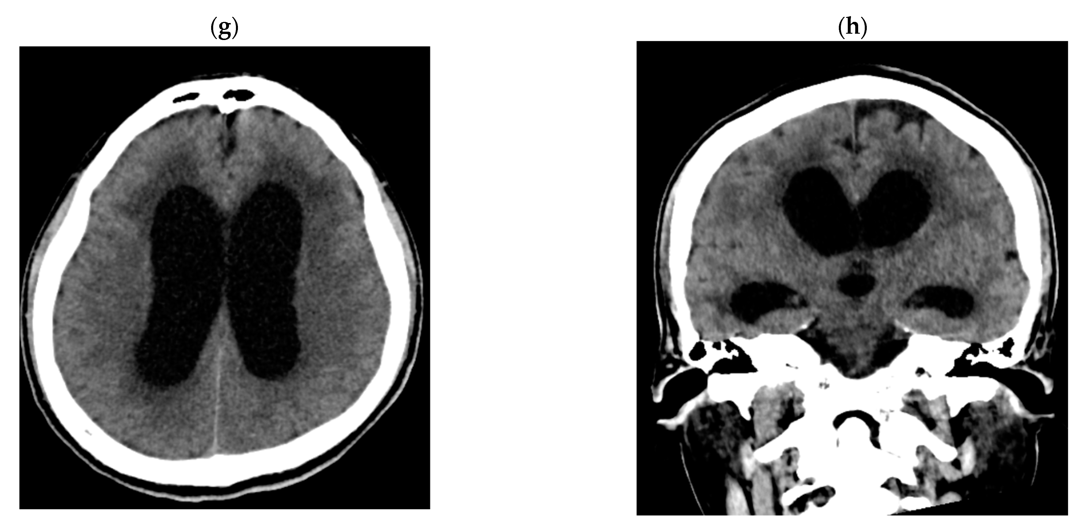 Tropicalmed 08 00182 g001b 550
