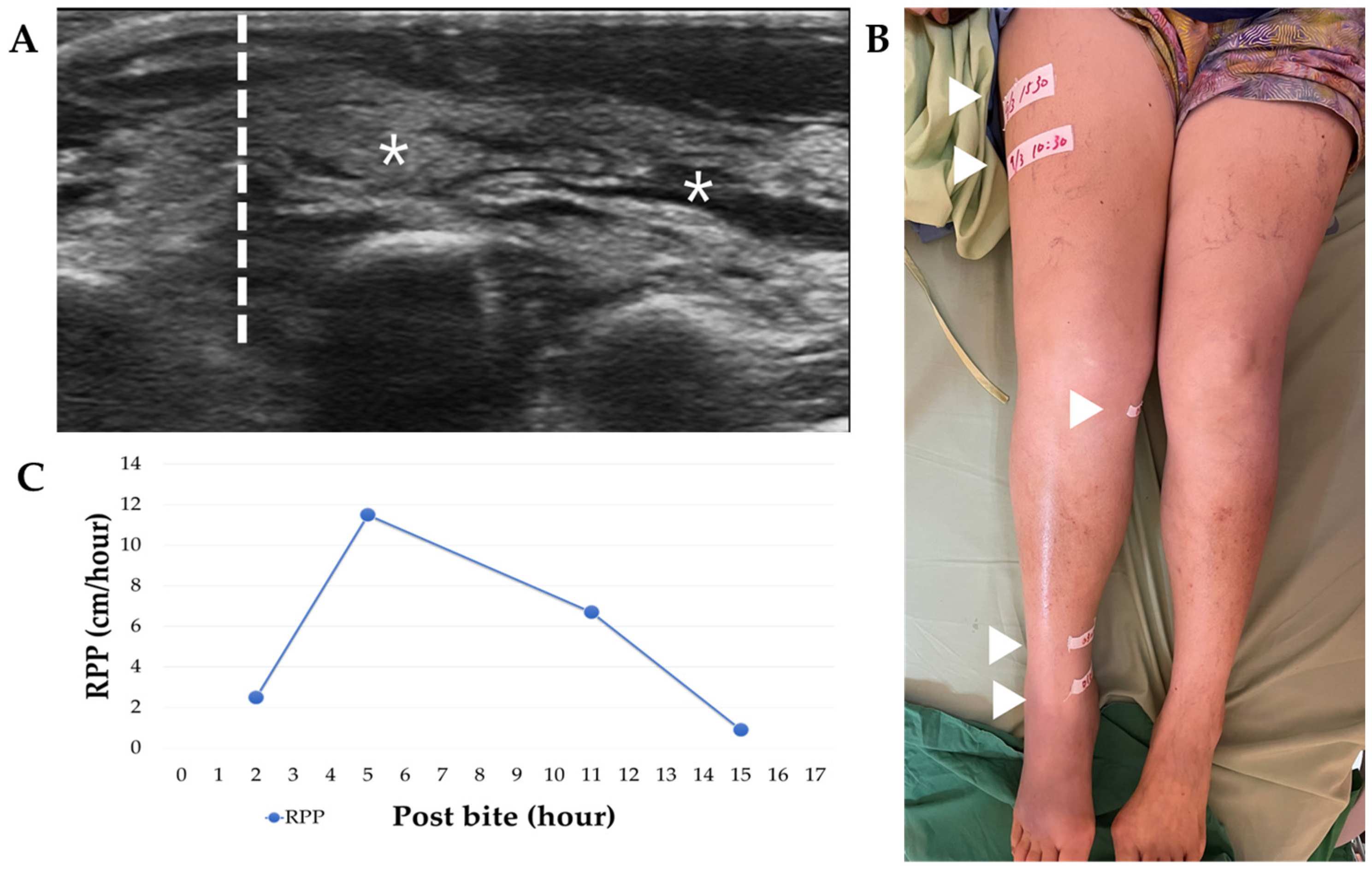 Tropicalmed 08 00246 g002 Tropicalmed 08 00246 g002