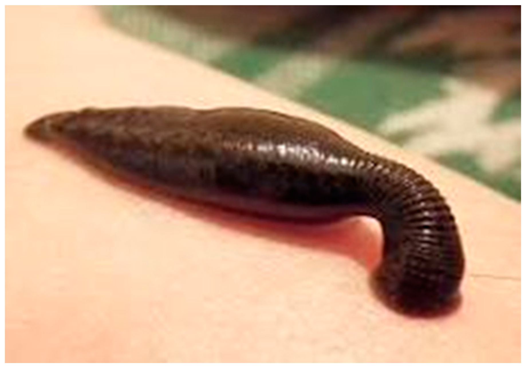 Tropicalmed 08 00275 g001 Tropicalmed 08 00275 g001