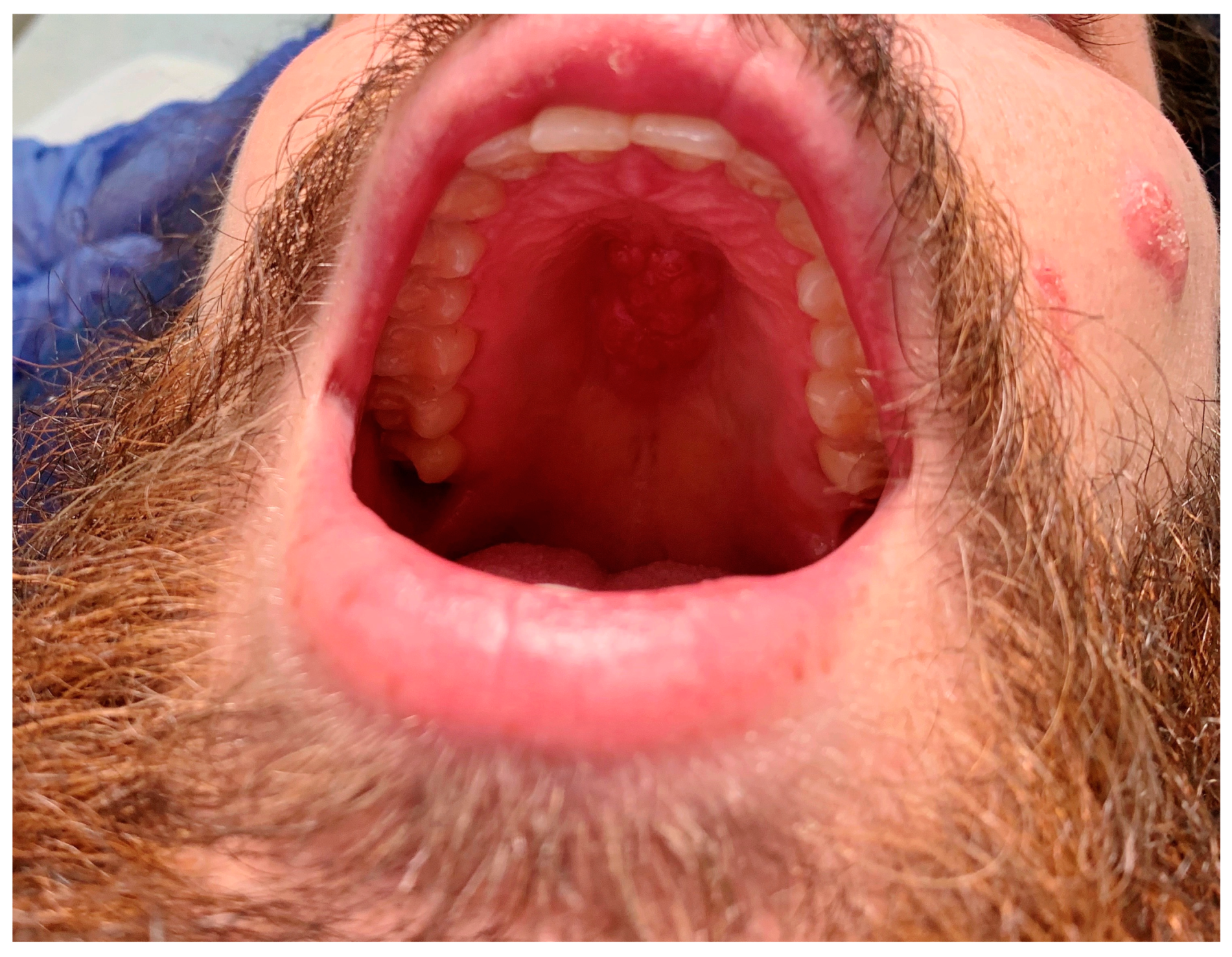 Tropicalmed 08 00371 g001