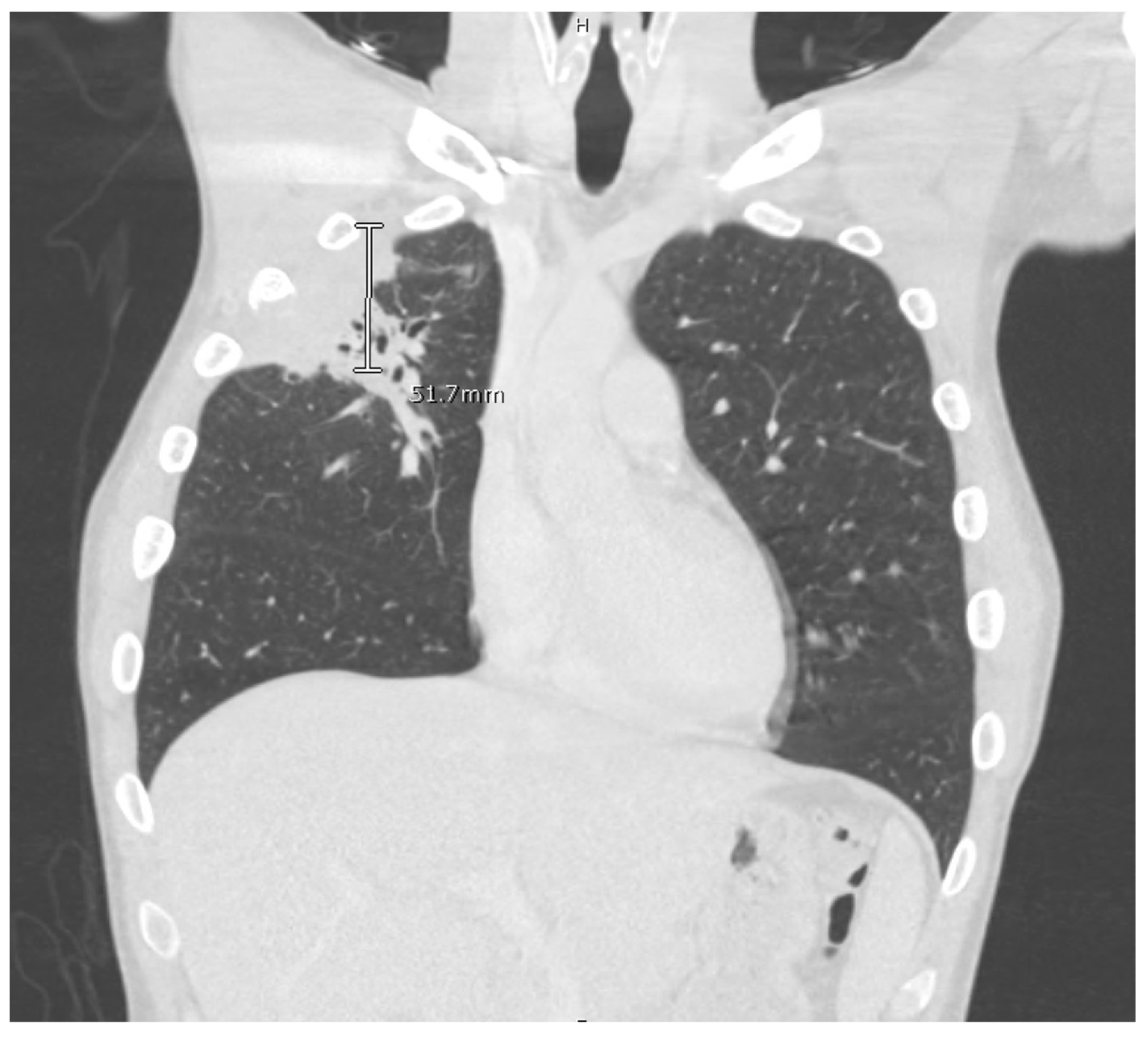 TropicalMed Free FullText Burying Hatchets into Endemic Diagnoses