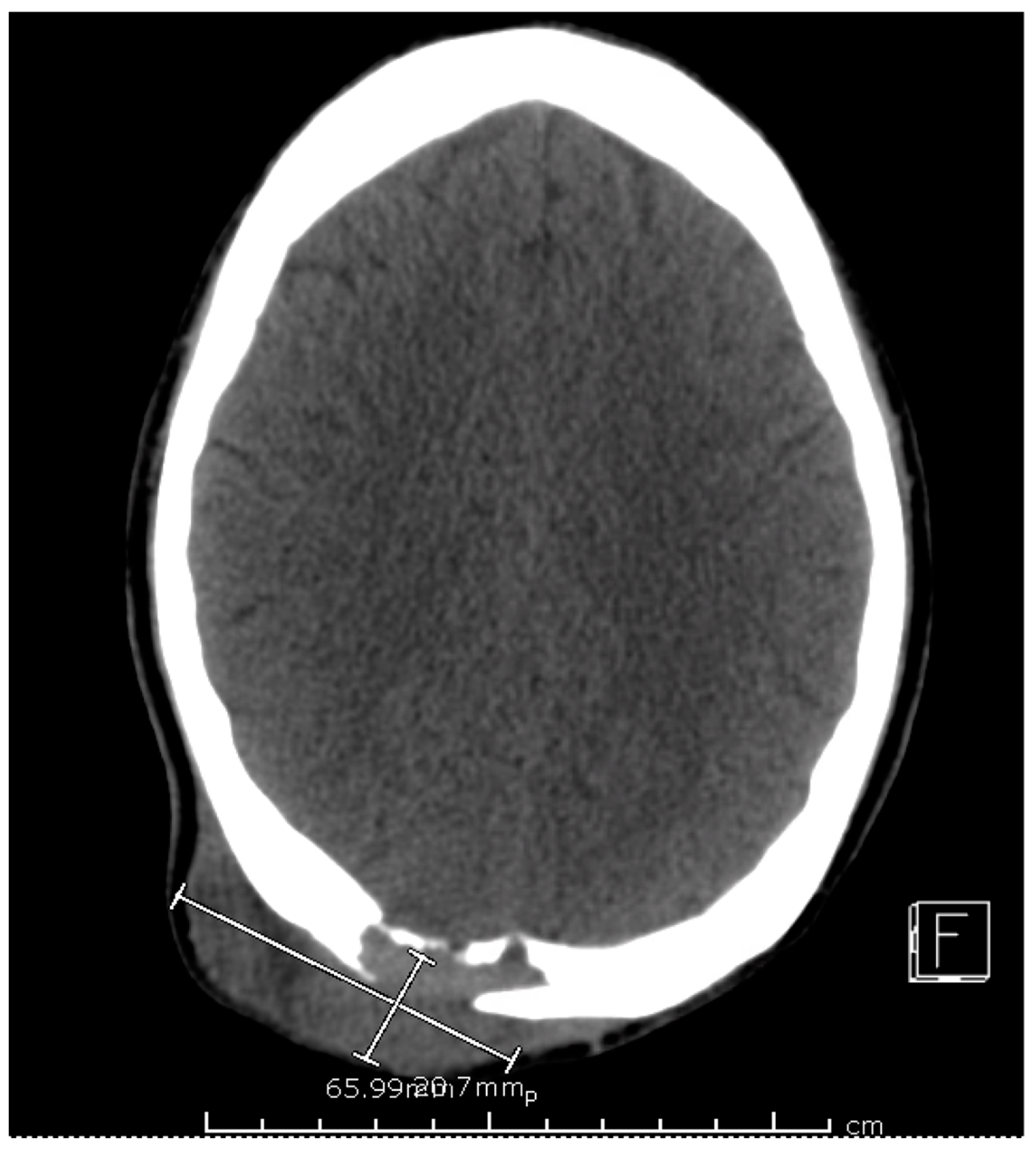 Tropicalmed 08 00371 g003