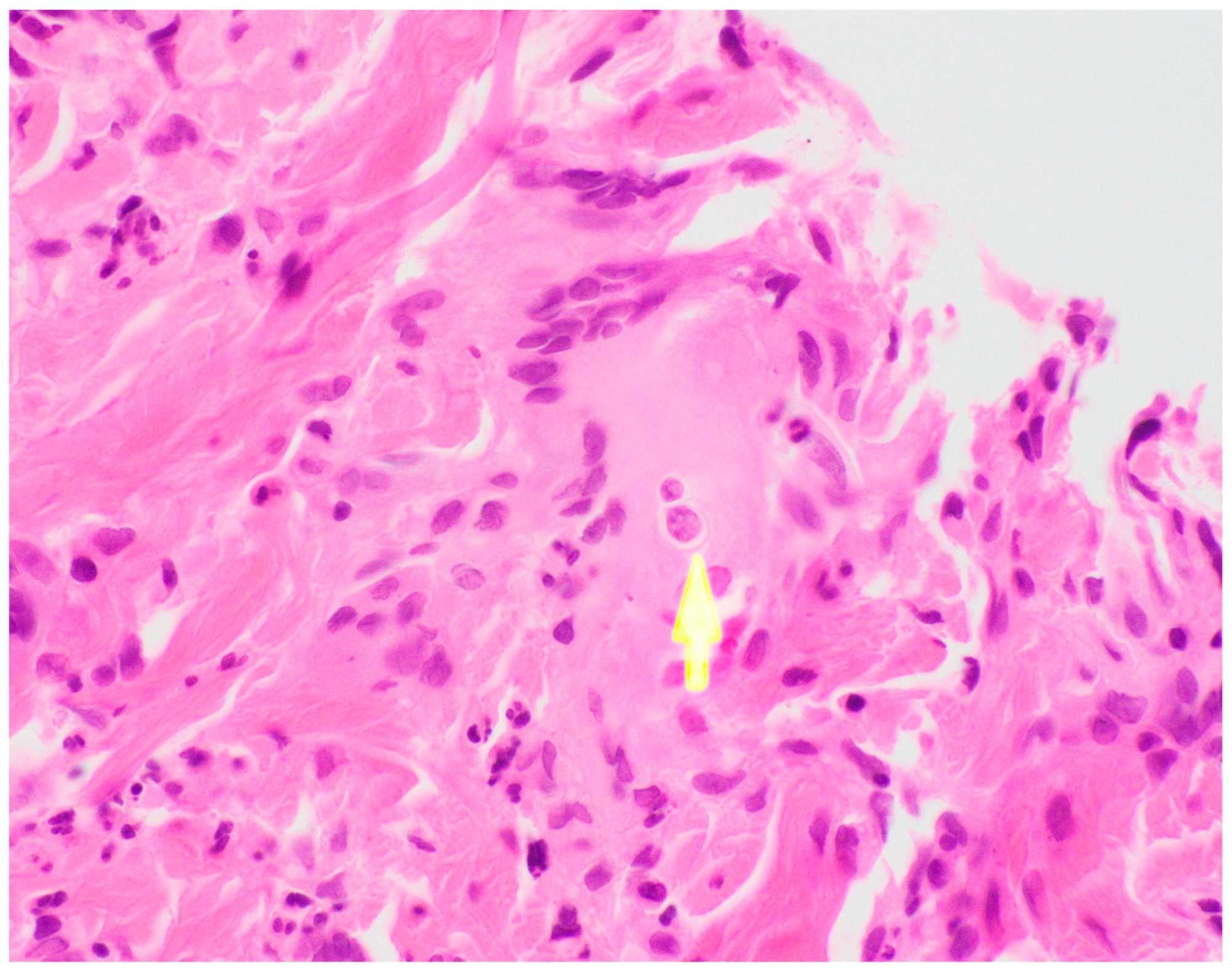 Tropicalmed 08 00371 g005