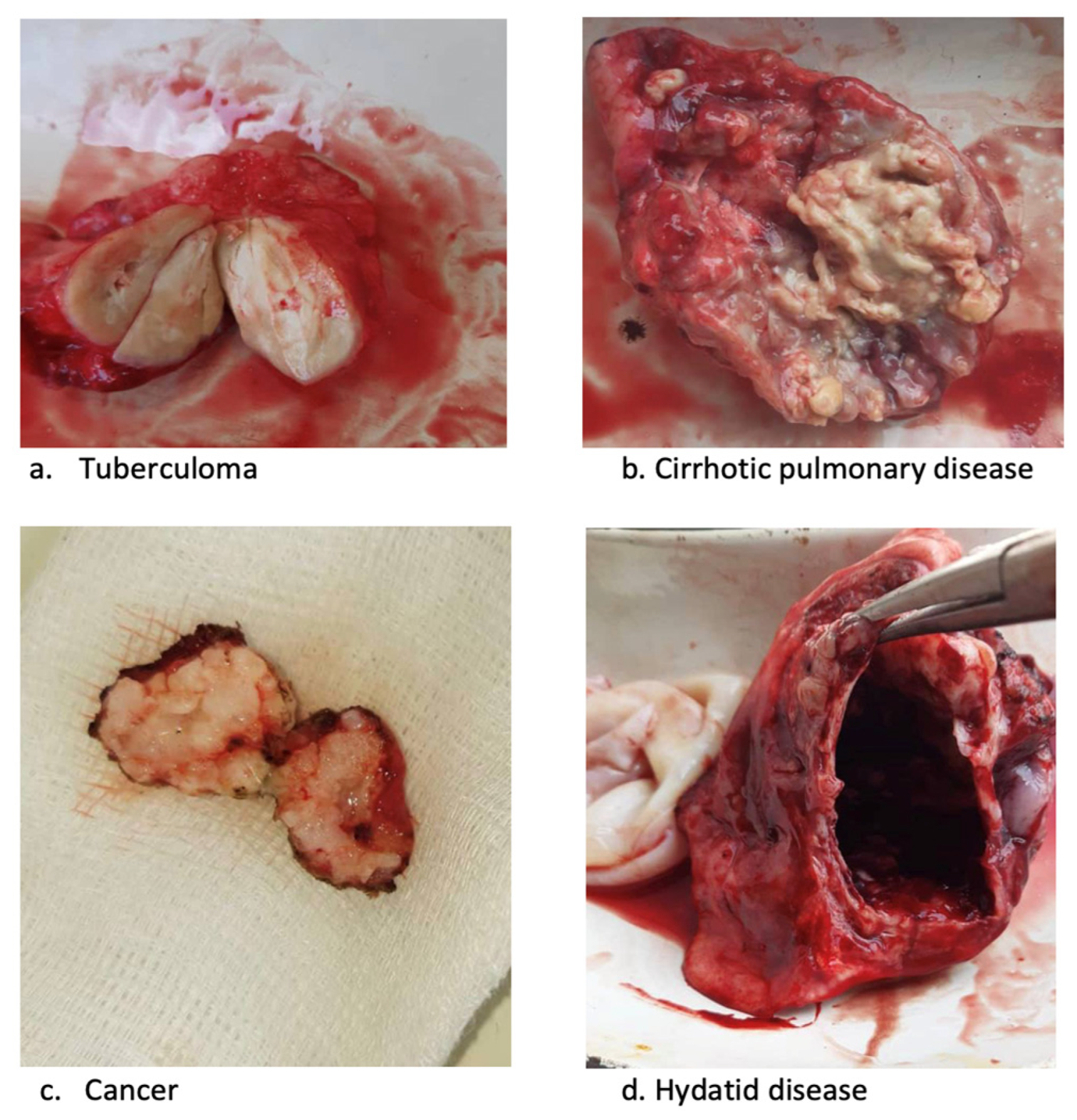 Tropicalmed 08 00393 g003