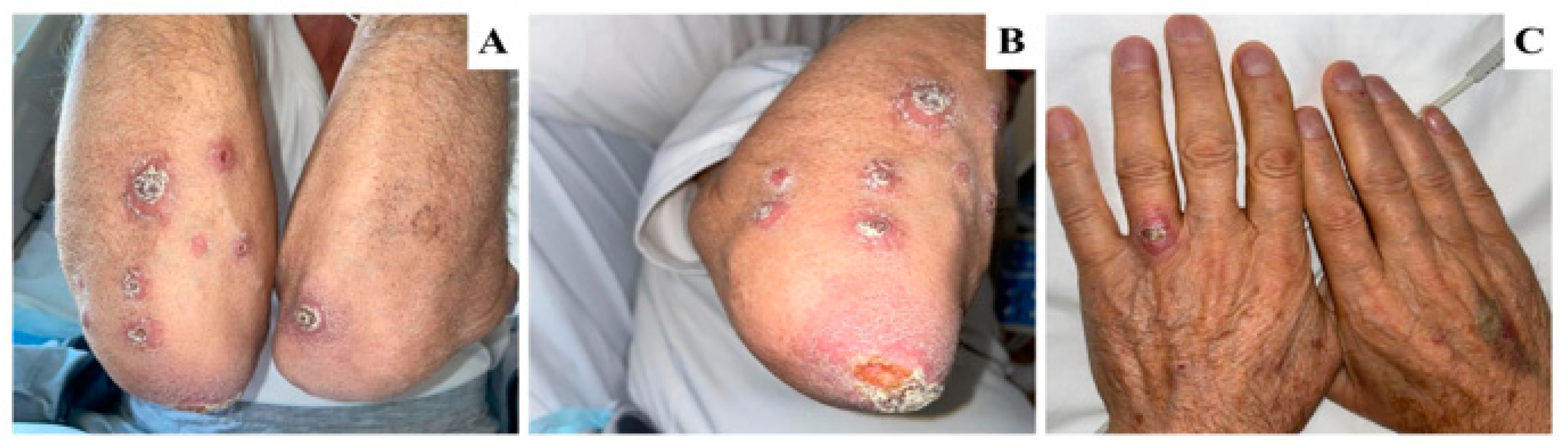 Tropicalmed 08 00443 g001