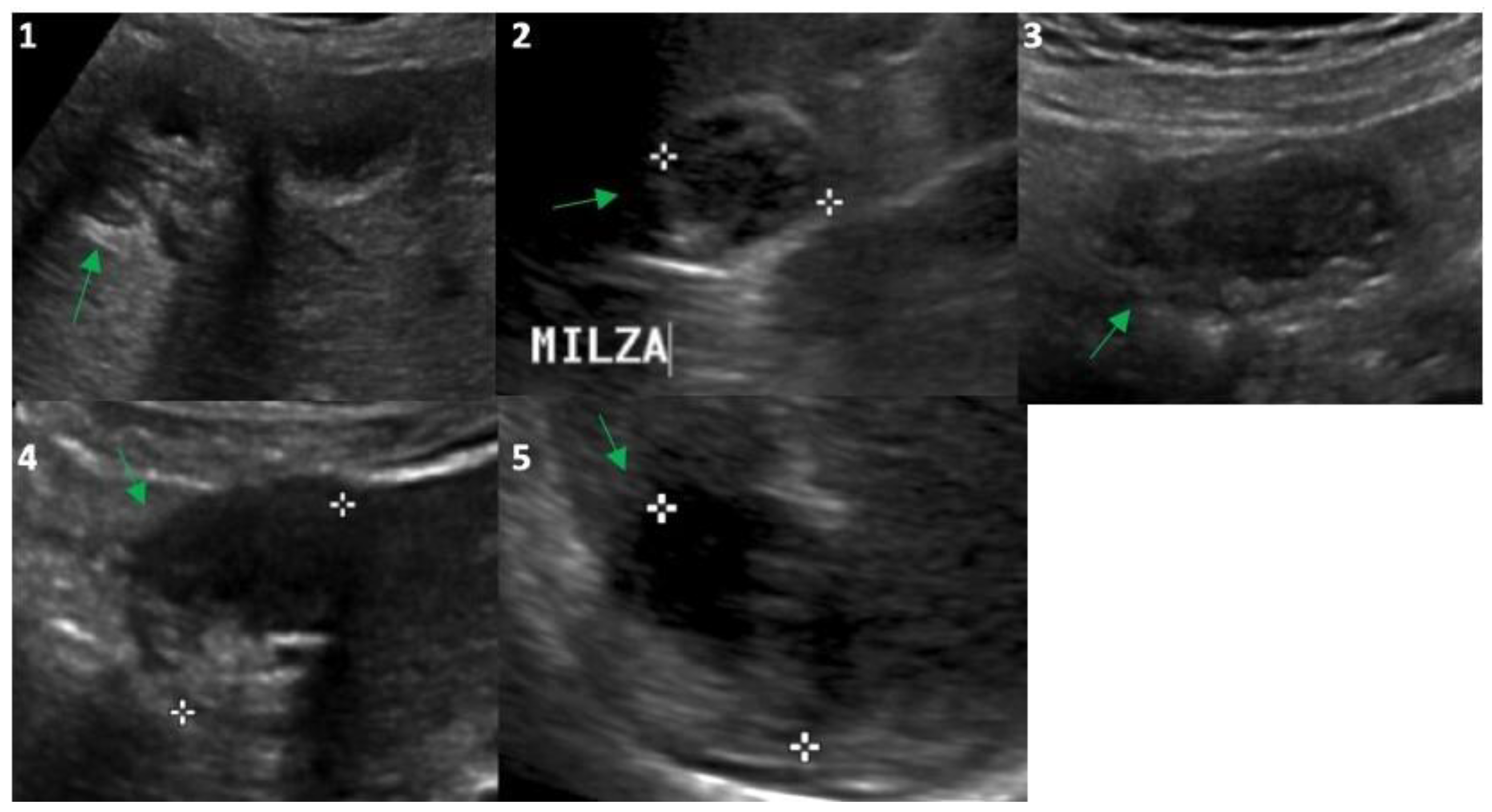 Tropicalmed 08 00449 g002