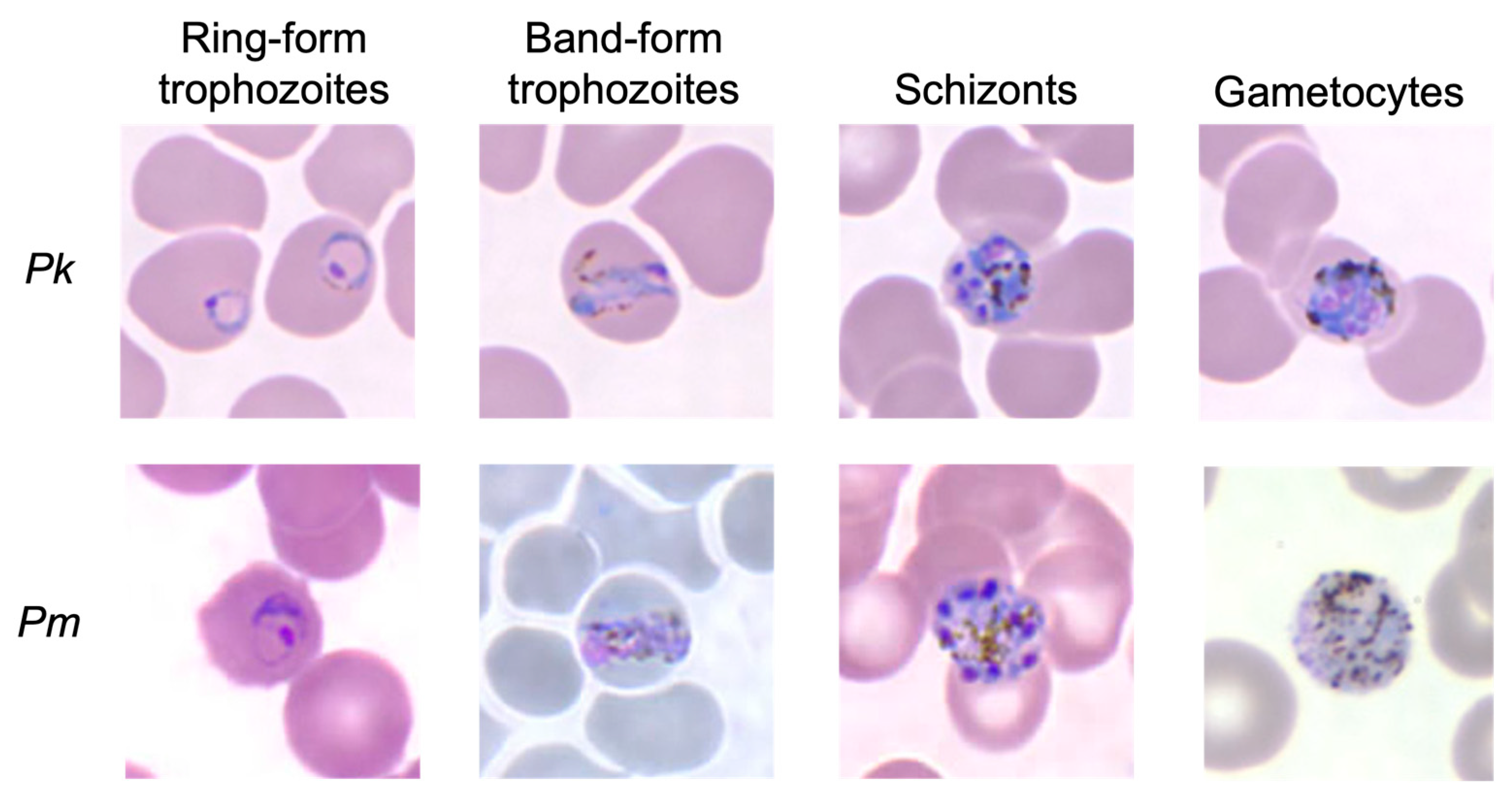 Plasmodium vivax ring form