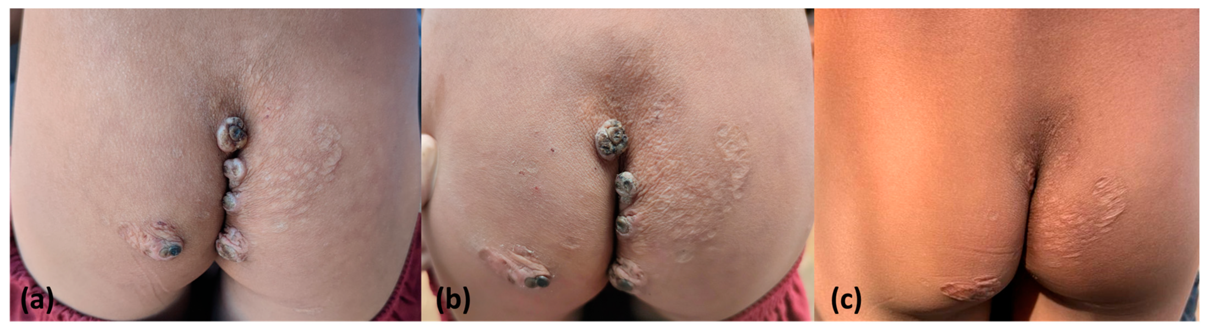 Tropicalmed 08 00489 g004