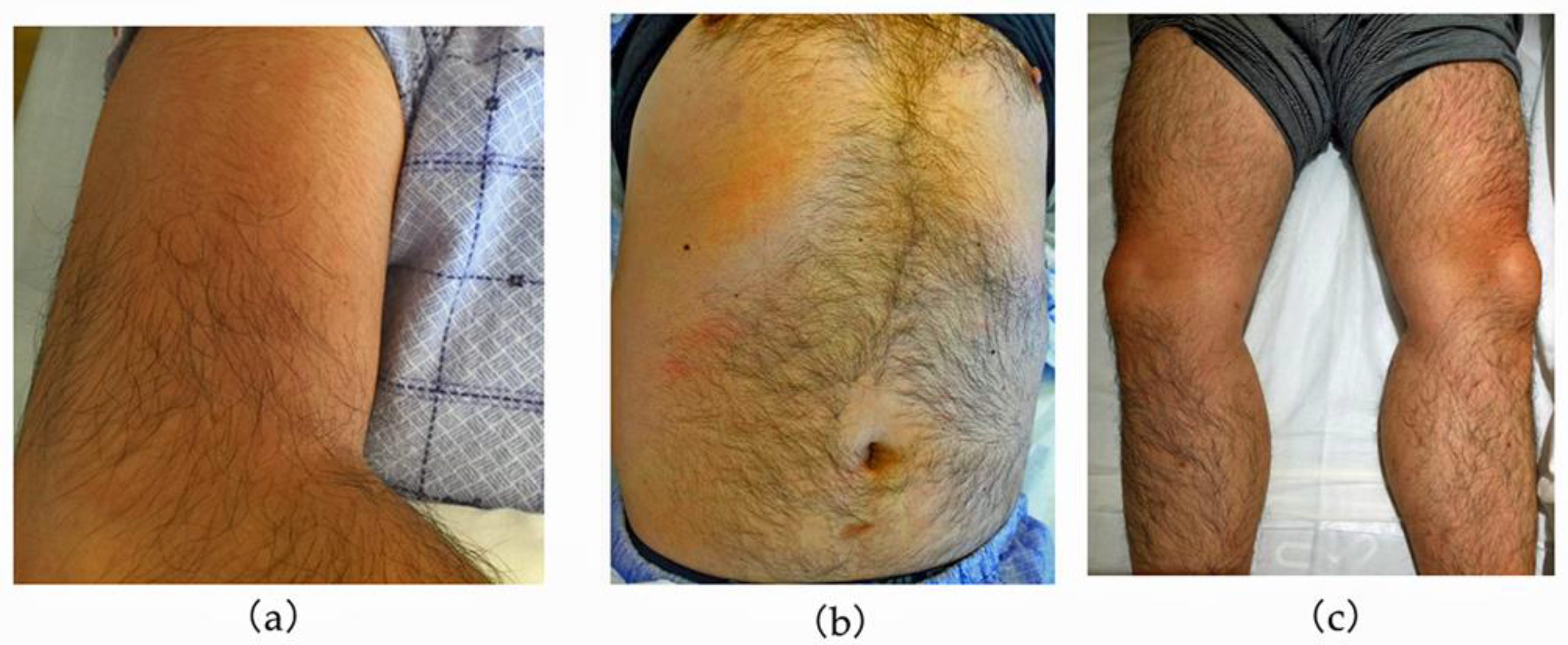 Tropicalmed 08 00497 g001 Tropicalmed 08 00497 g001