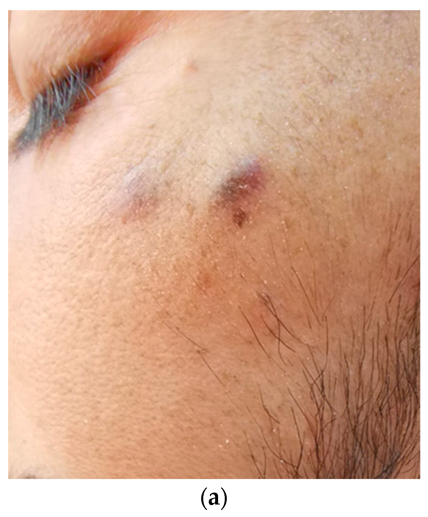 Tropicalmed 09 00047 g001a Tropicalmed 09 00047 g001a