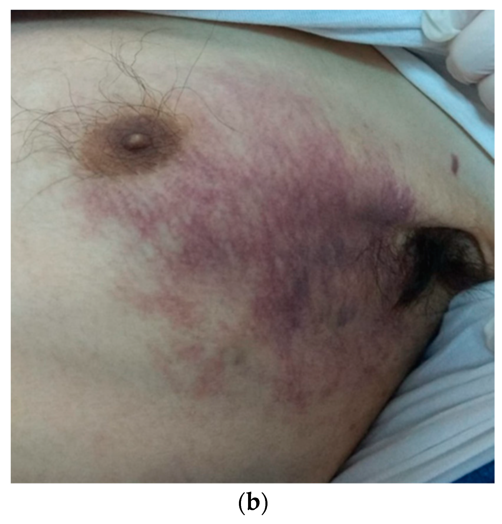 Tropicalmed 09 00047 g001b Tropicalmed 09 00047 g001b