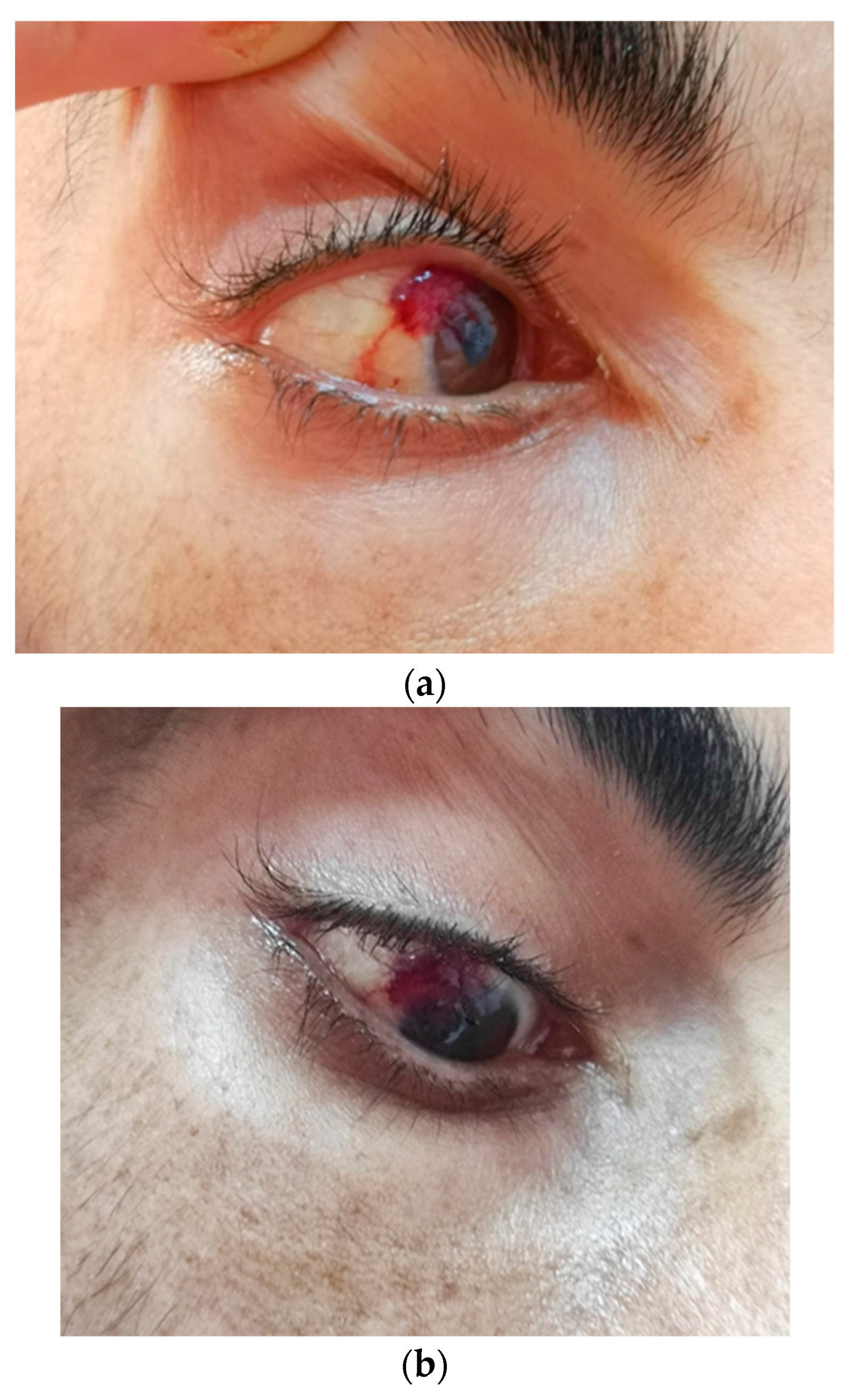 Tropicalmed 09 00047 g002 Tropicalmed 09 00047 g002