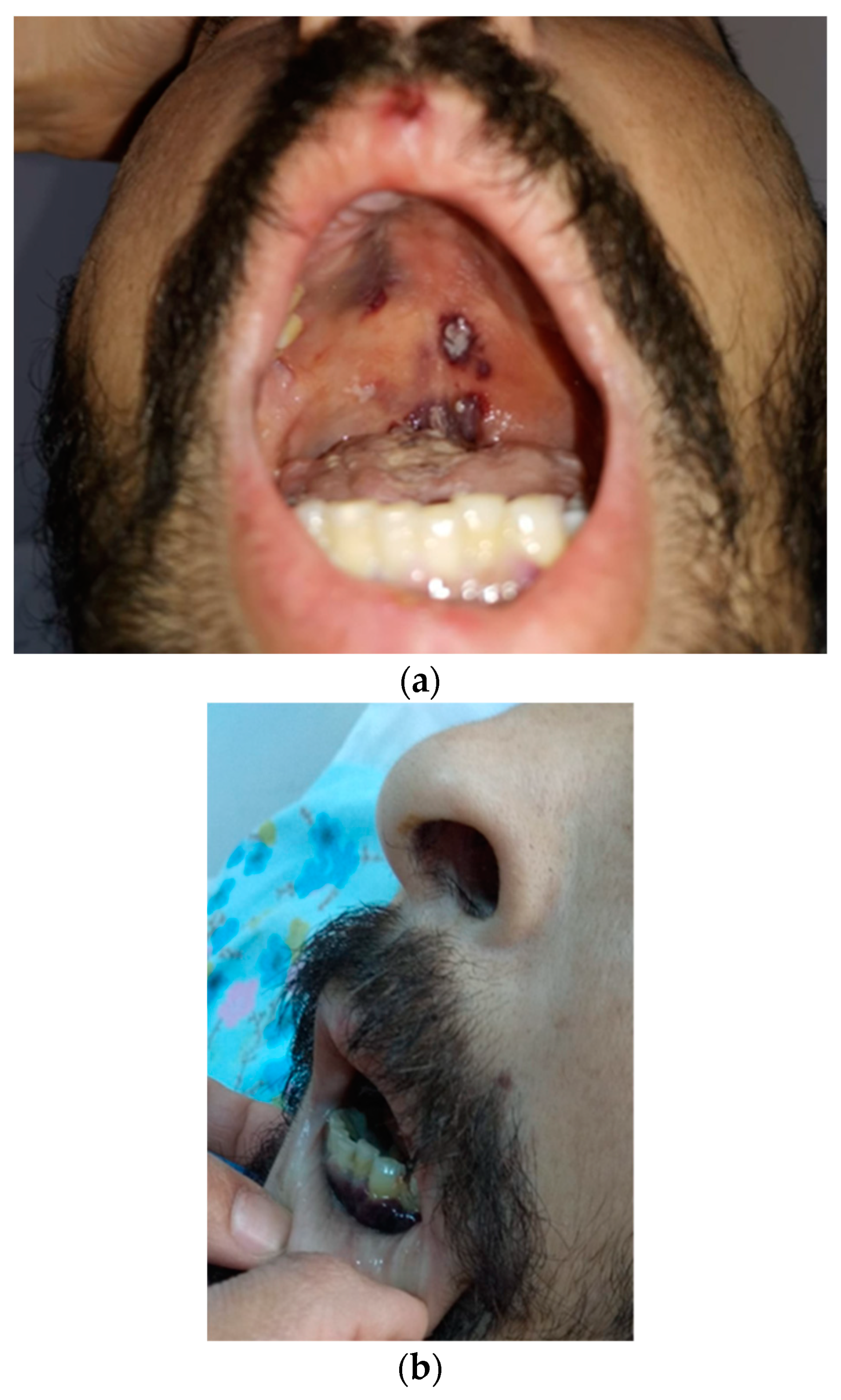 Tropicalmed 09 00047 g003 Tropicalmed 09 00047 g003