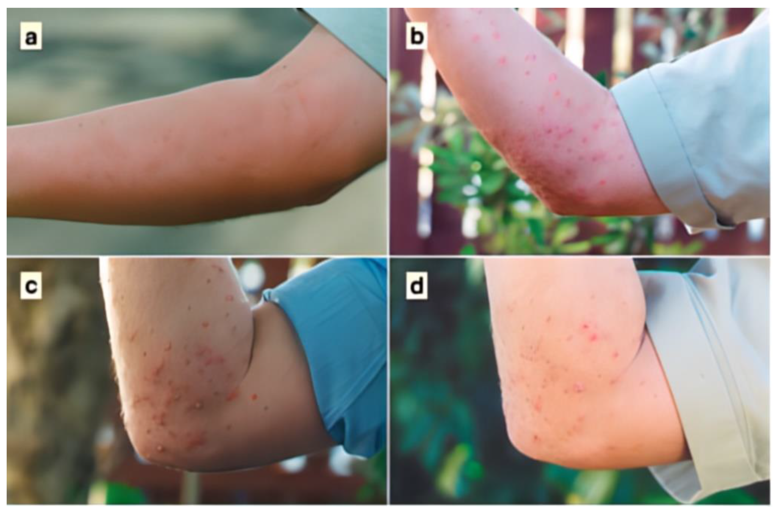 See The Disturbing Images: Are Ant Bites Harming Your Dog? - 4x6jsgk