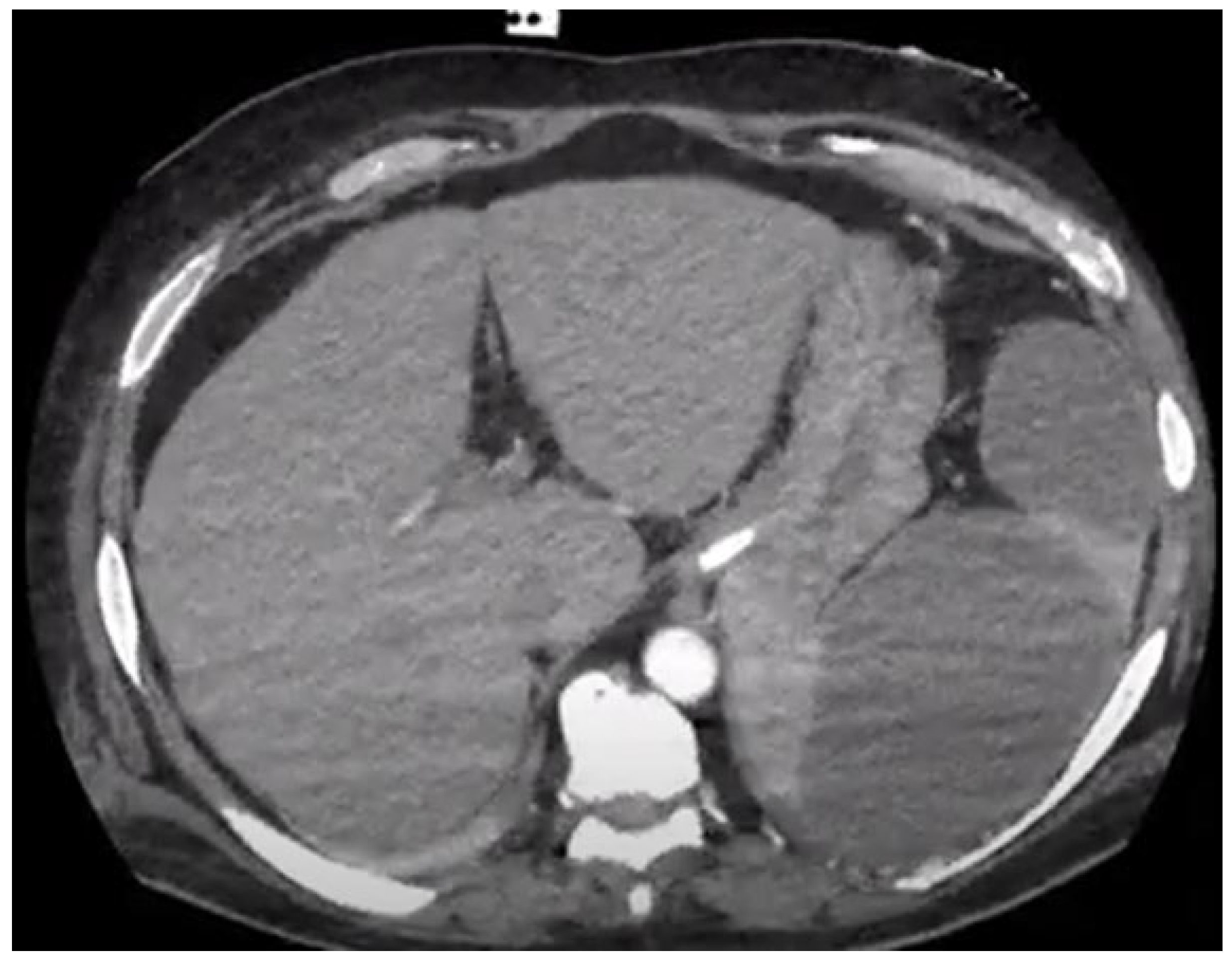 Tropicalmed 09 00083 g002