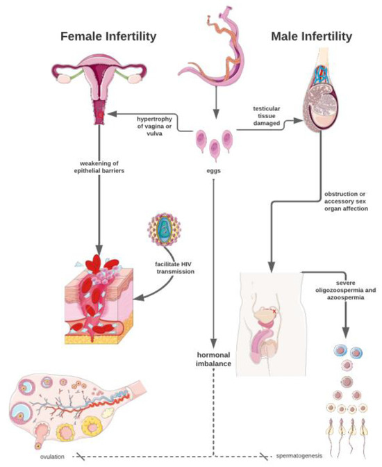 Insights into the State of the Art of Urogenital Schistosomiasis 