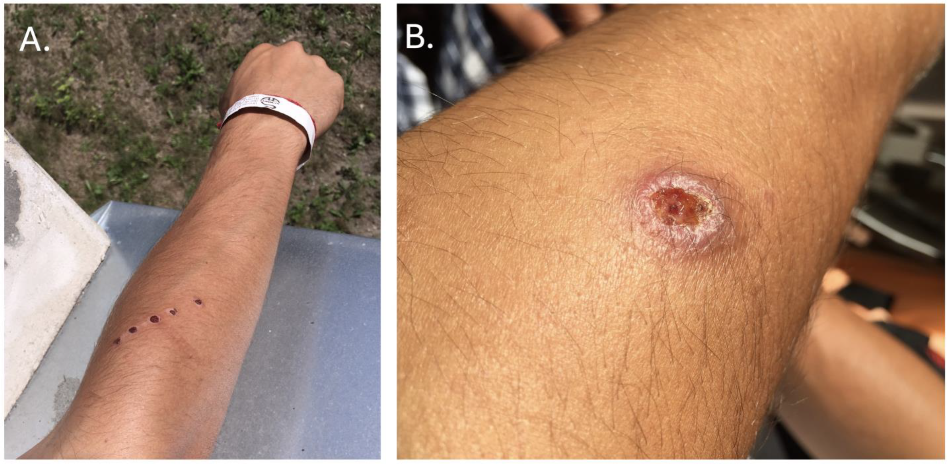 Tropicalmed 09 00227 g001 Tropicalmed 09 00227 g001