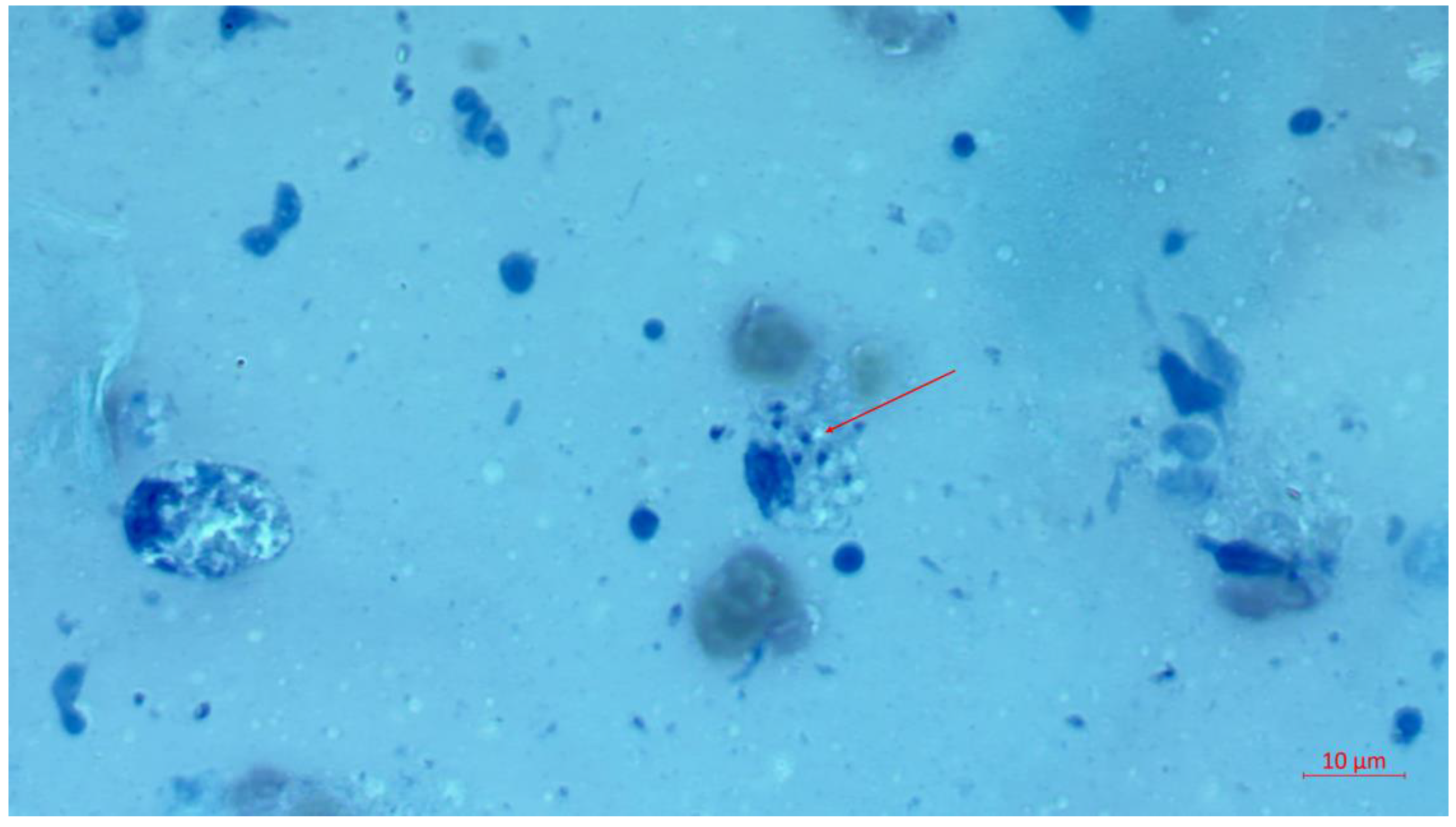 Tropicalmed 09 00227 g002 Tropicalmed 09 00227 g002