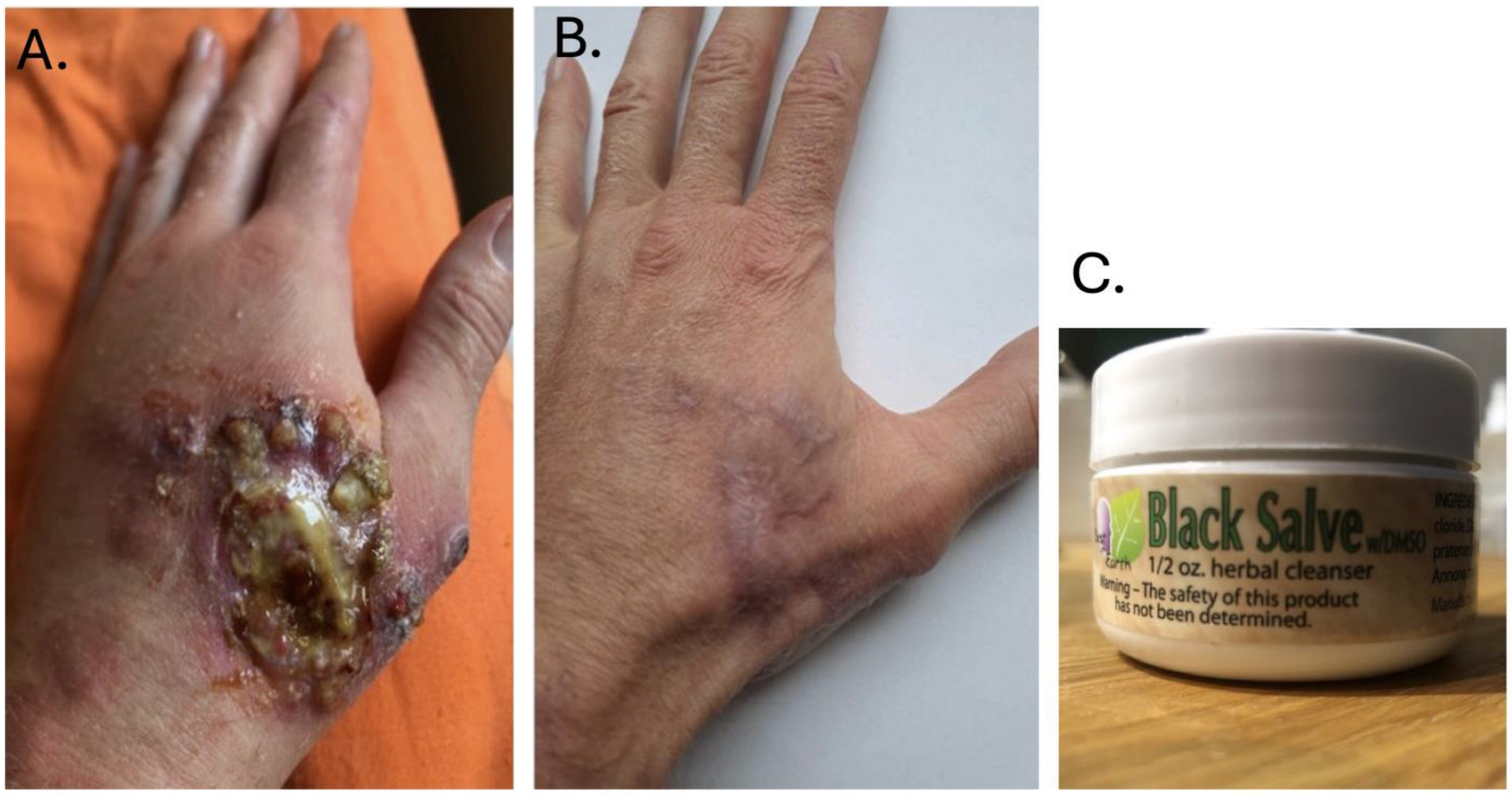 Tropicalmed 09 00227 g003 Tropicalmed 09 00227 g003