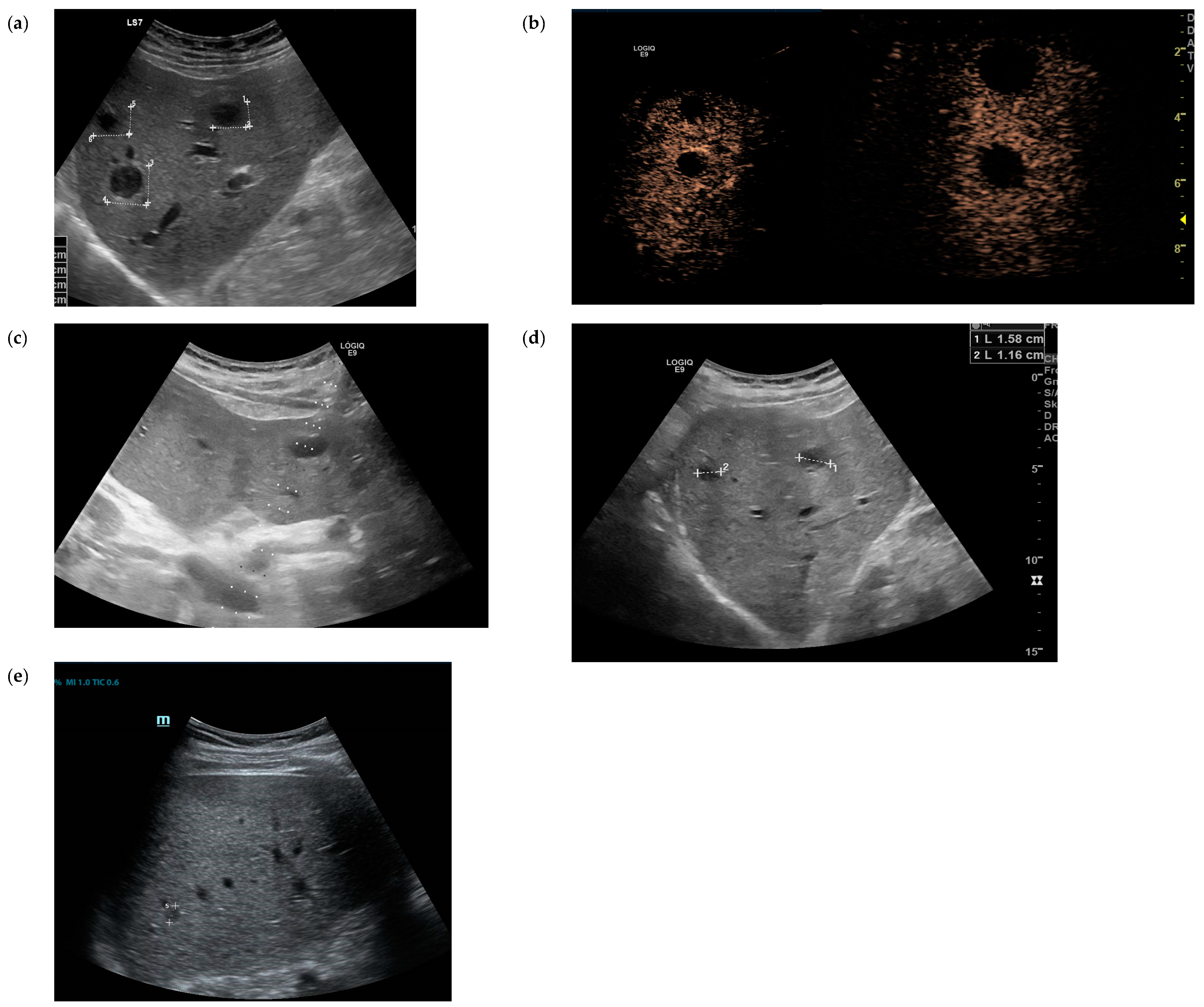 Tropicalmed 09 00242 g002 Tropicalmed 09 00242 g002