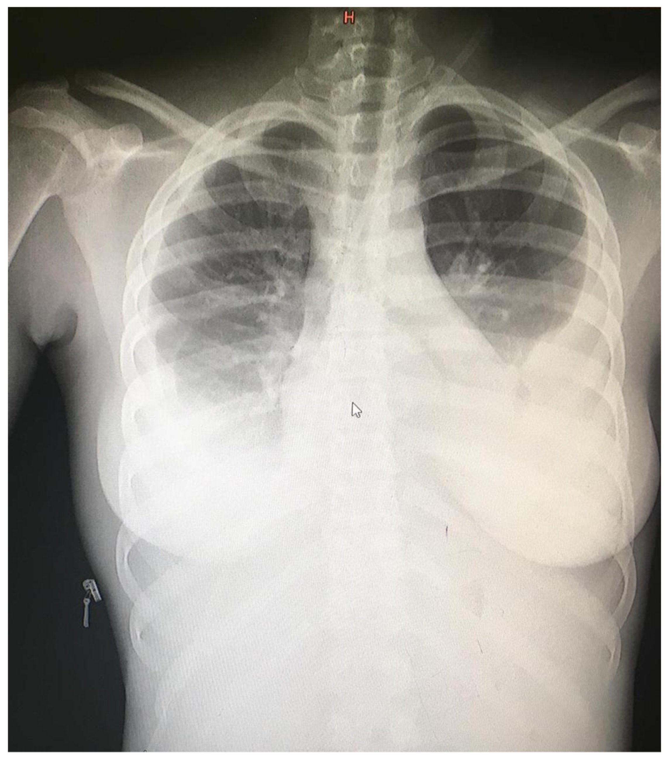 Tropicalmed 09 00307 g002