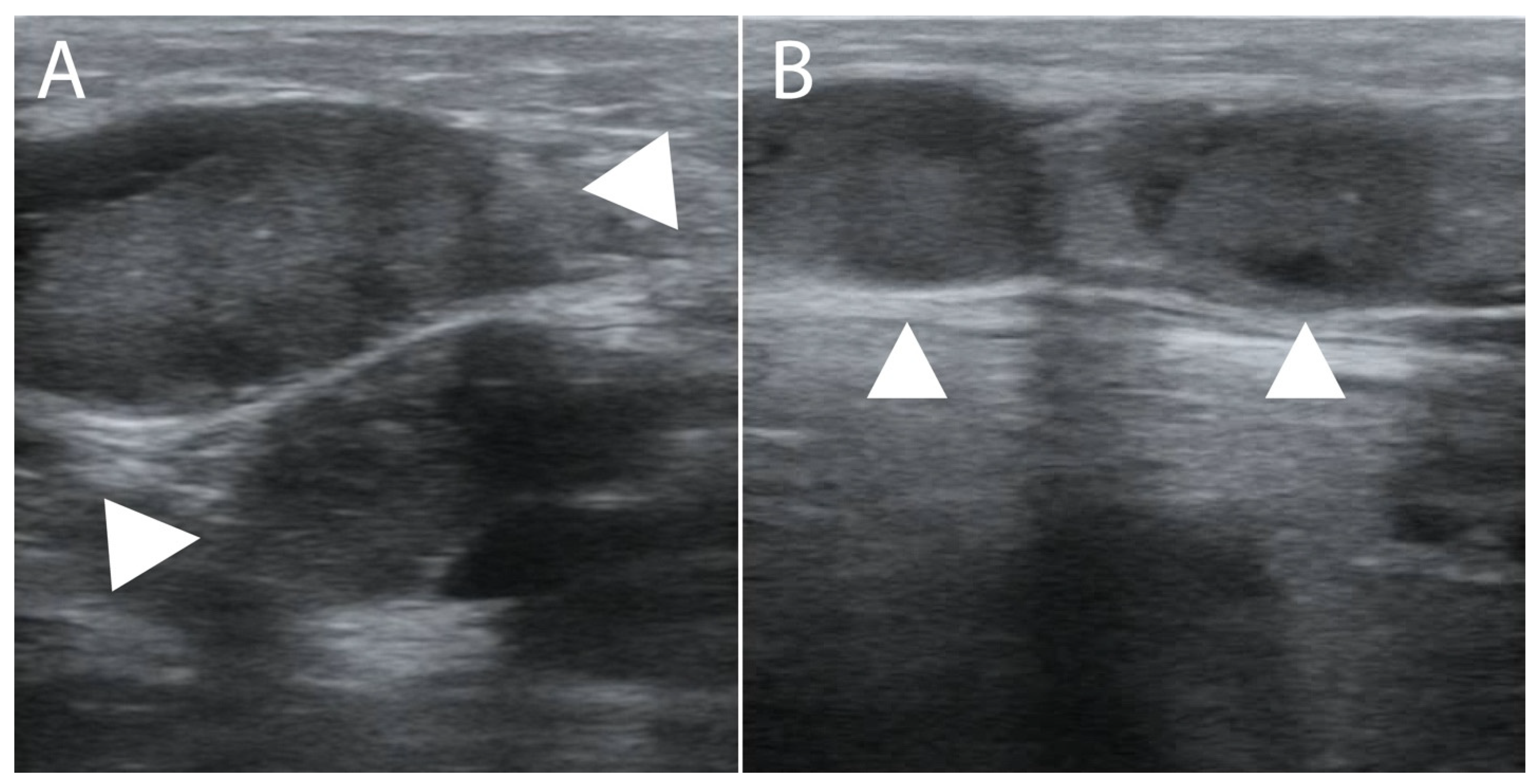 Tropicalmed 09 00307 g004