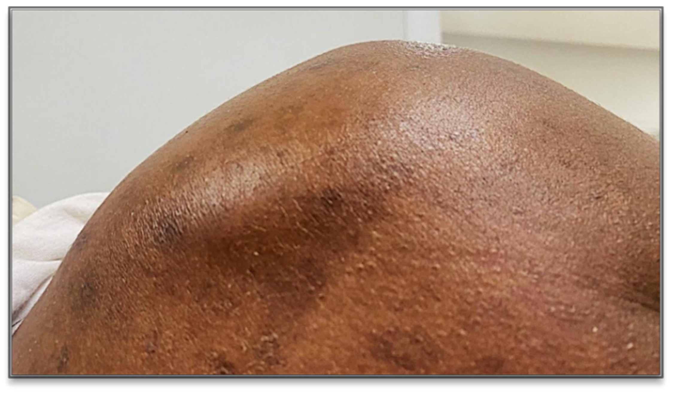 Tropicalmed 10 00008 g001