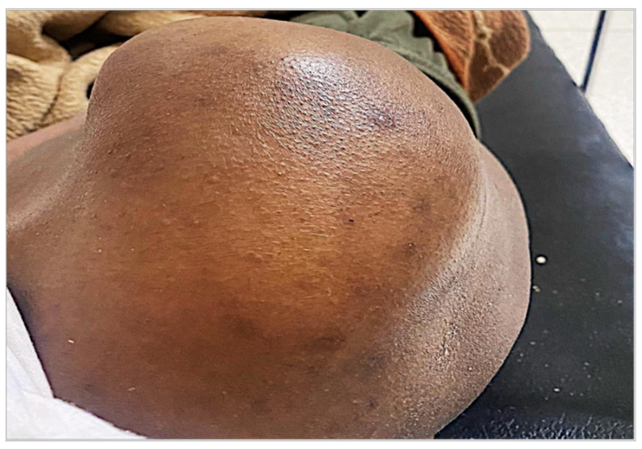 Tropicalmed 10 00008 g002