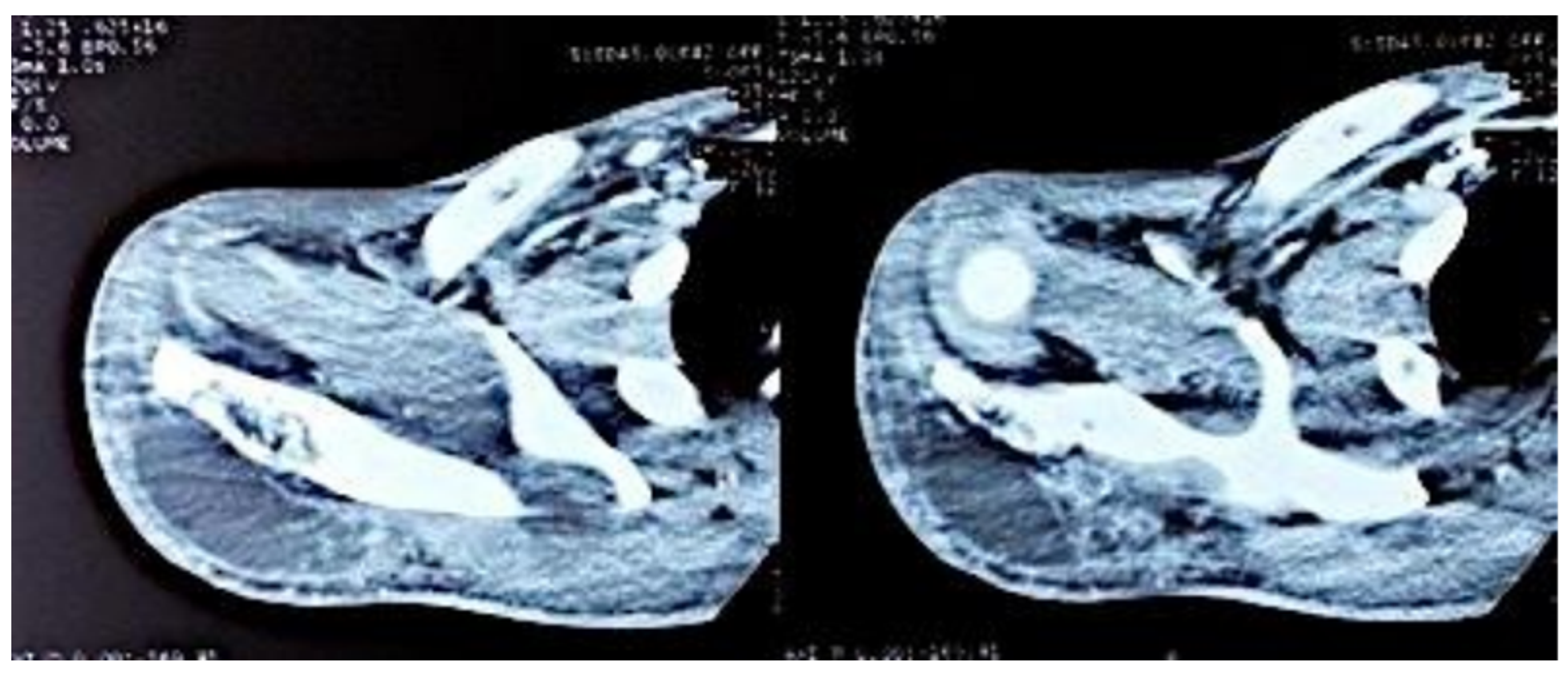 Tropicalmed 10 00008 g003