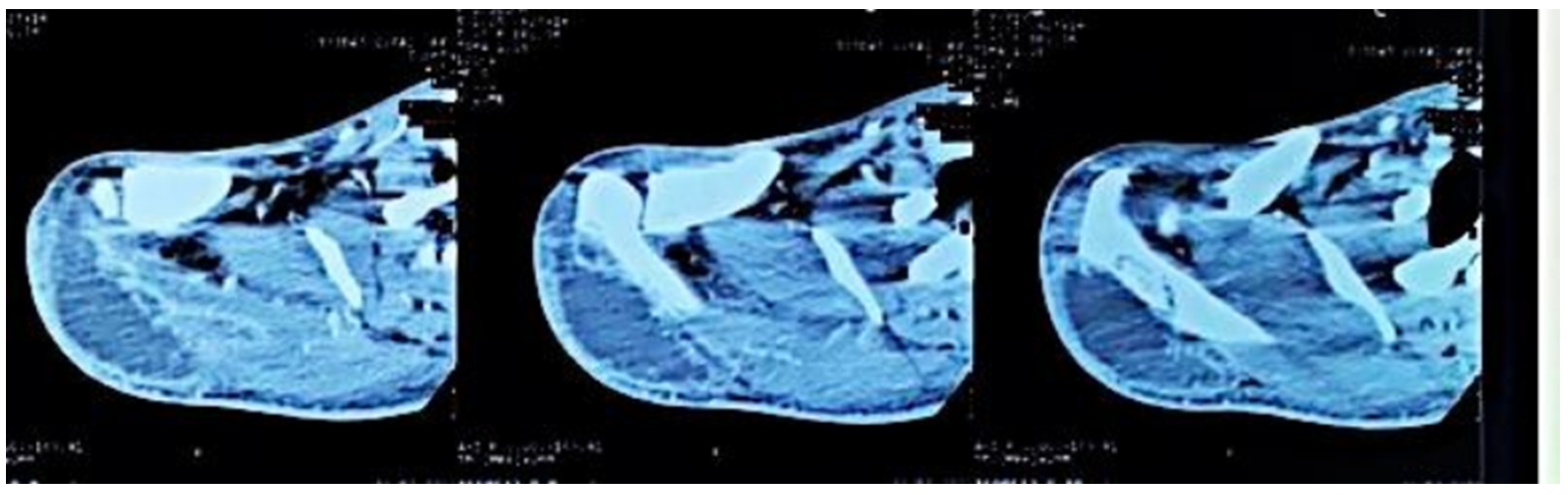 Tropicalmed 10 00008 g004