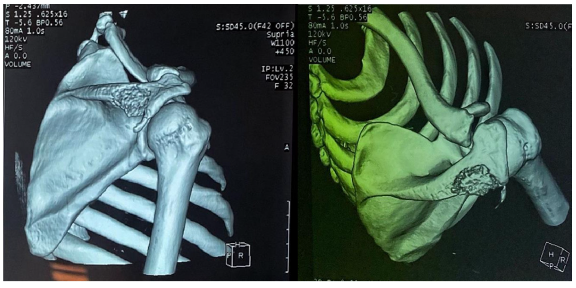 Tropicalmed 10 00008 g005