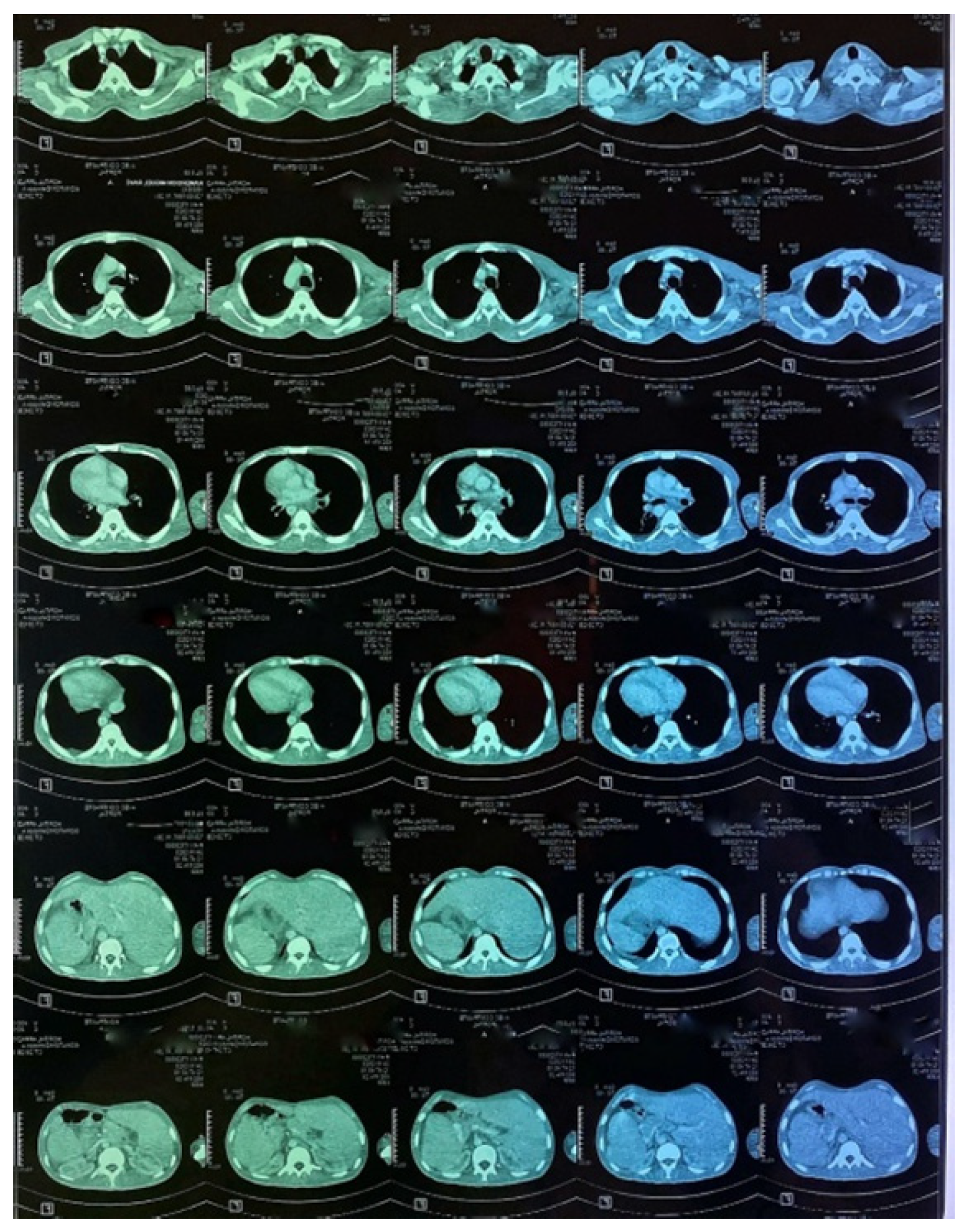 Tropicalmed 10 00008 g006
