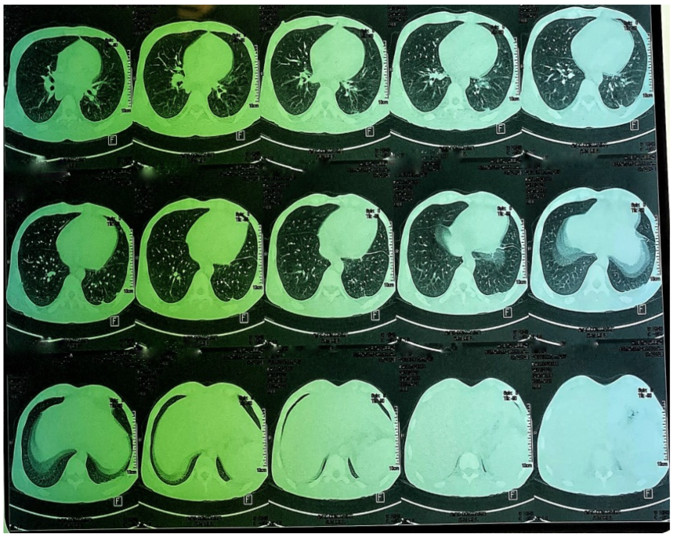 Tropicalmed 10 00008 g007