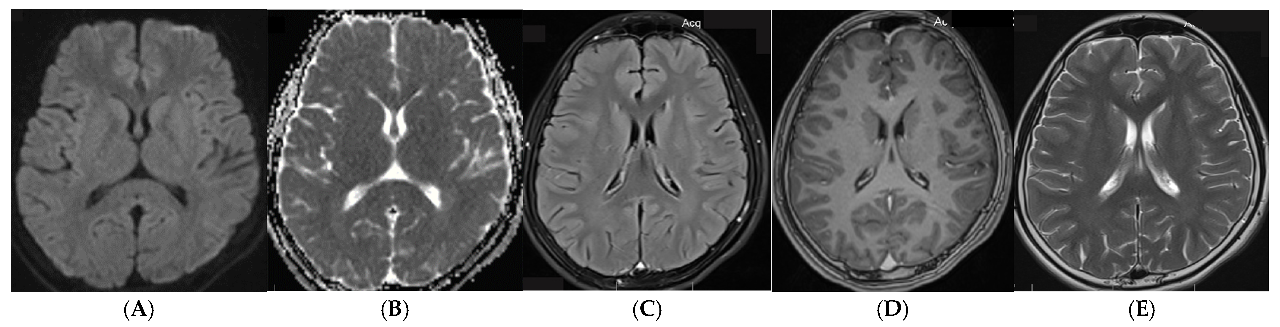 Tropicalmed 10 00096 g002