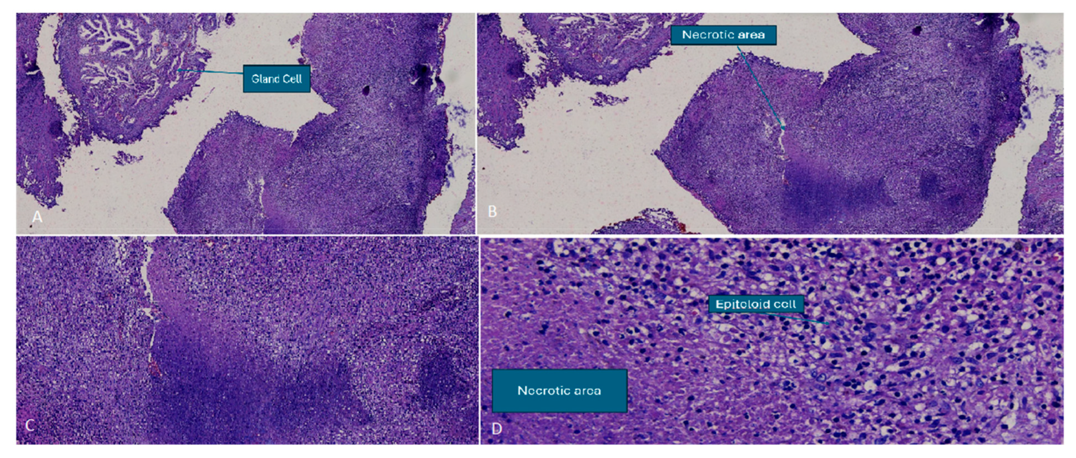 Tropicalmed 10 00145 g002