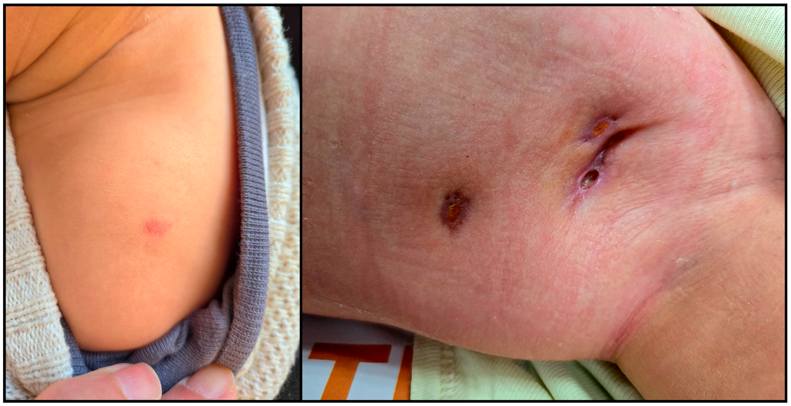 Tropicalmed 10 00148 g002