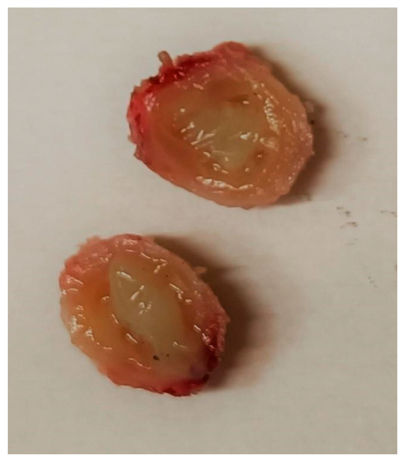 Tropicalmed 10 00184 g003