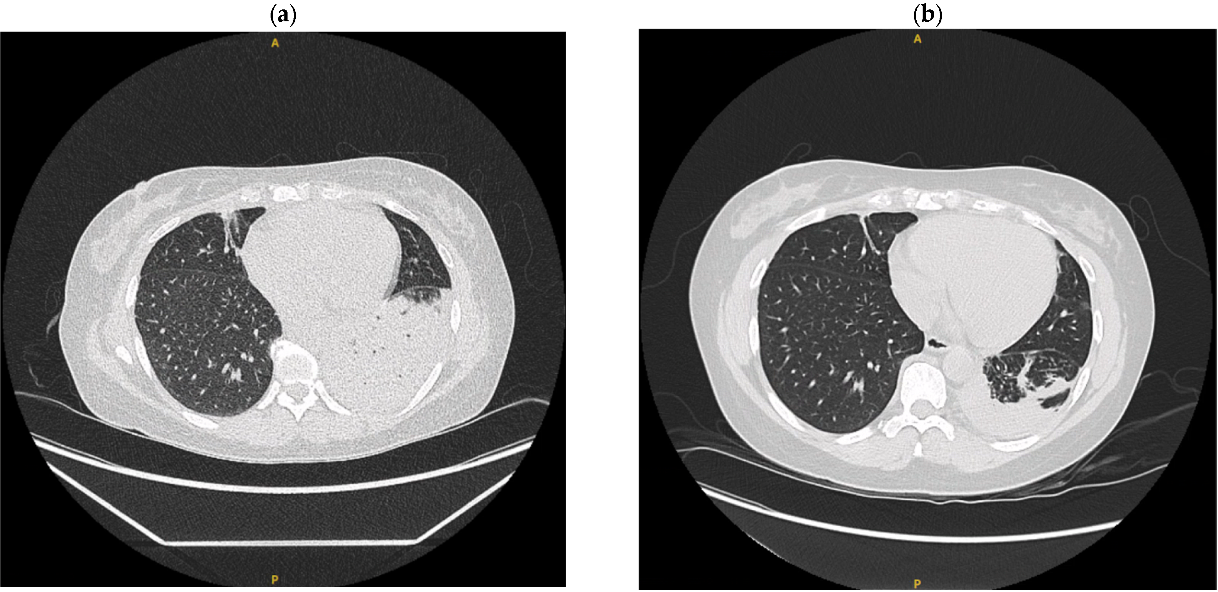 Tropicalmed 10 00202 g003 Tropicalmed 10 00202 g003