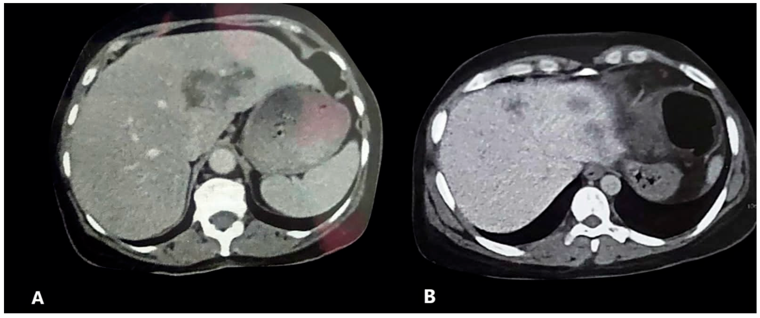 Tropicalmed 10 00221 g002 Tropicalmed 10 00221 g002