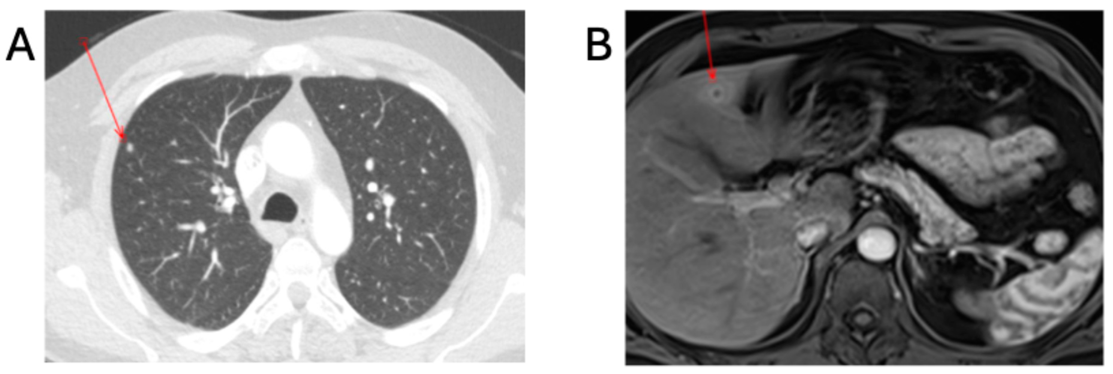 Tropicalmed 10 00227 g002