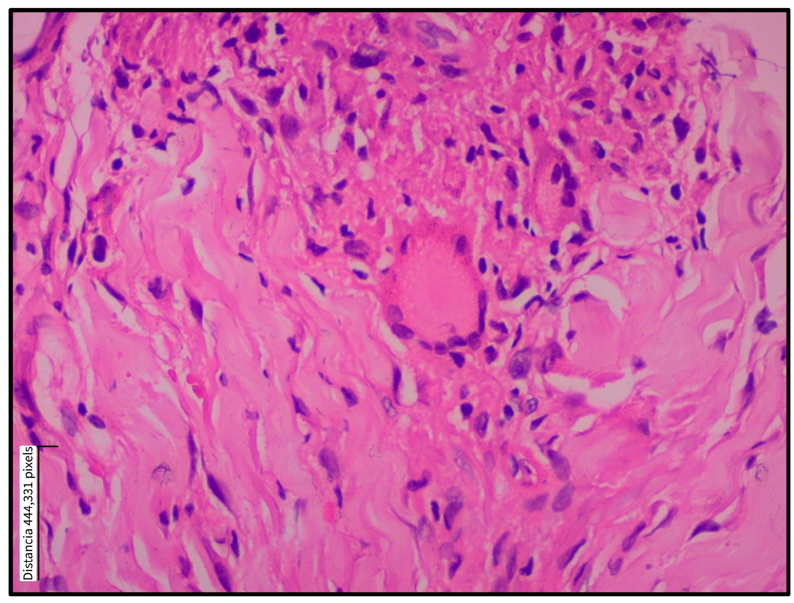 Tropicalmed 10 00232 g003 Tropicalmed 10 00232 g003