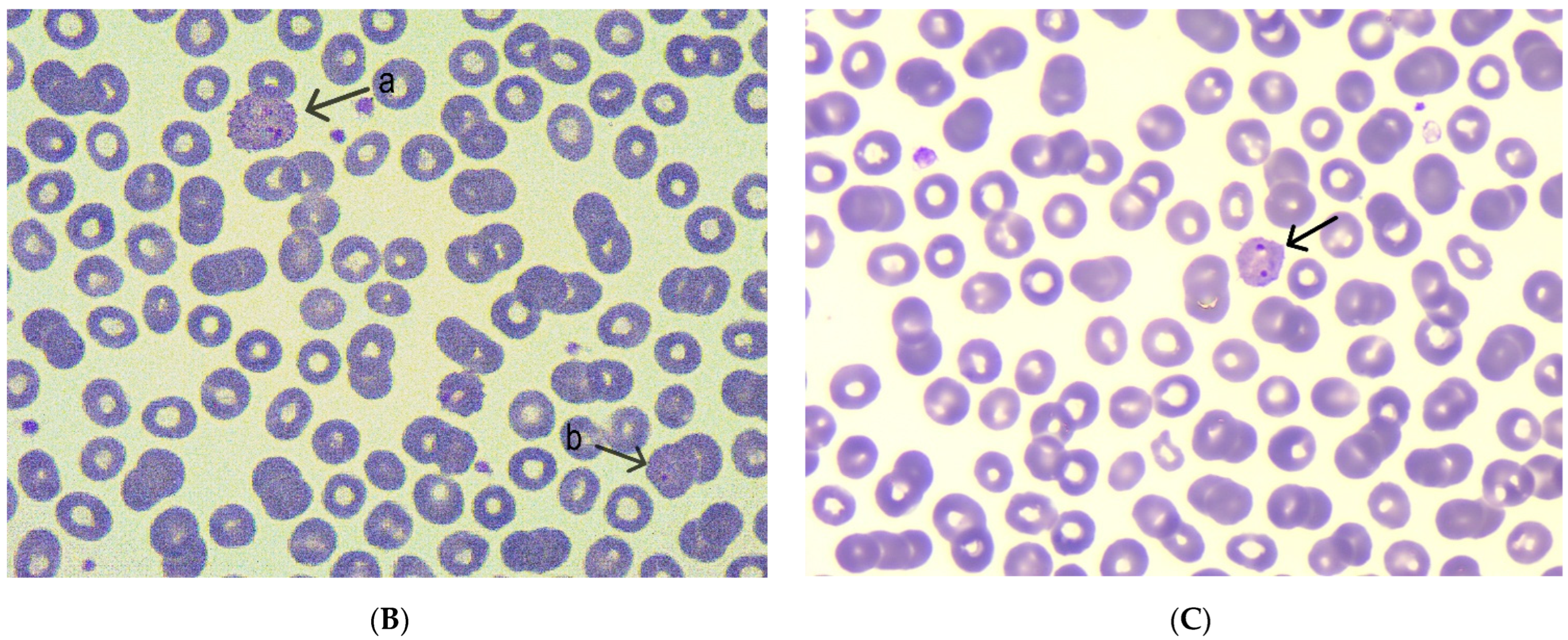 Tropicalmed 10 00261 g001b