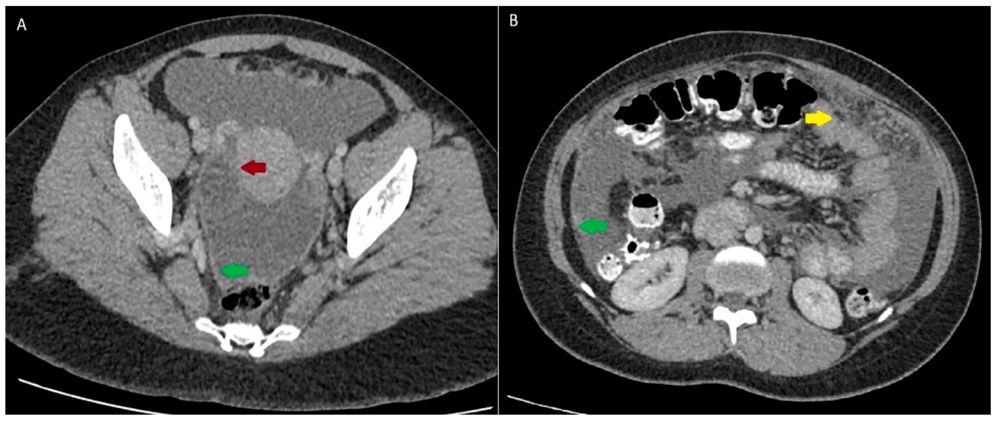 Tropicalmed 10 00346 g001