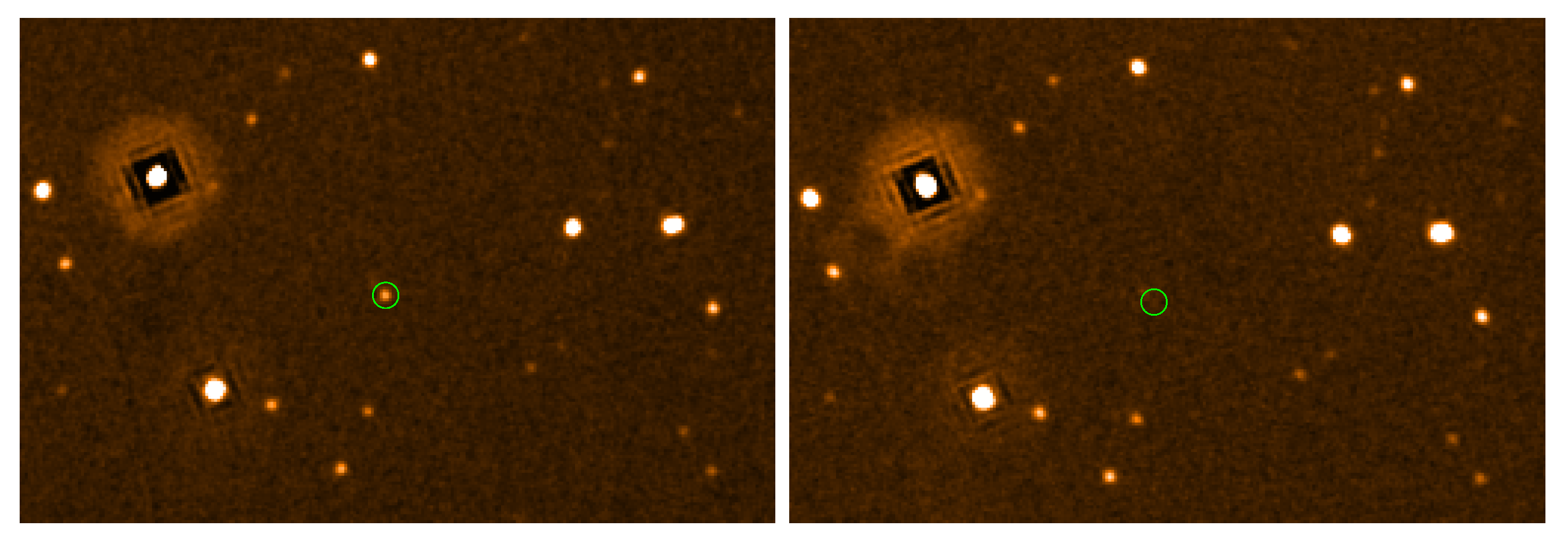 GRB 181110A: Constraining the Jet Structure, Circumburst