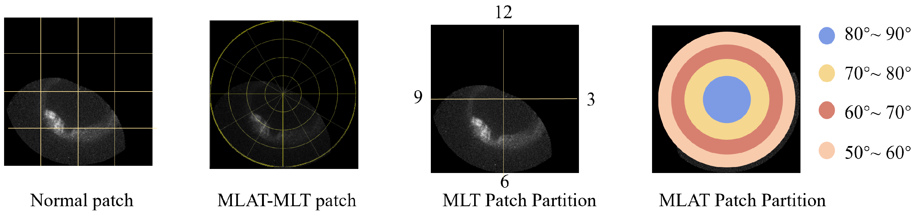Universe 11 00265 g009