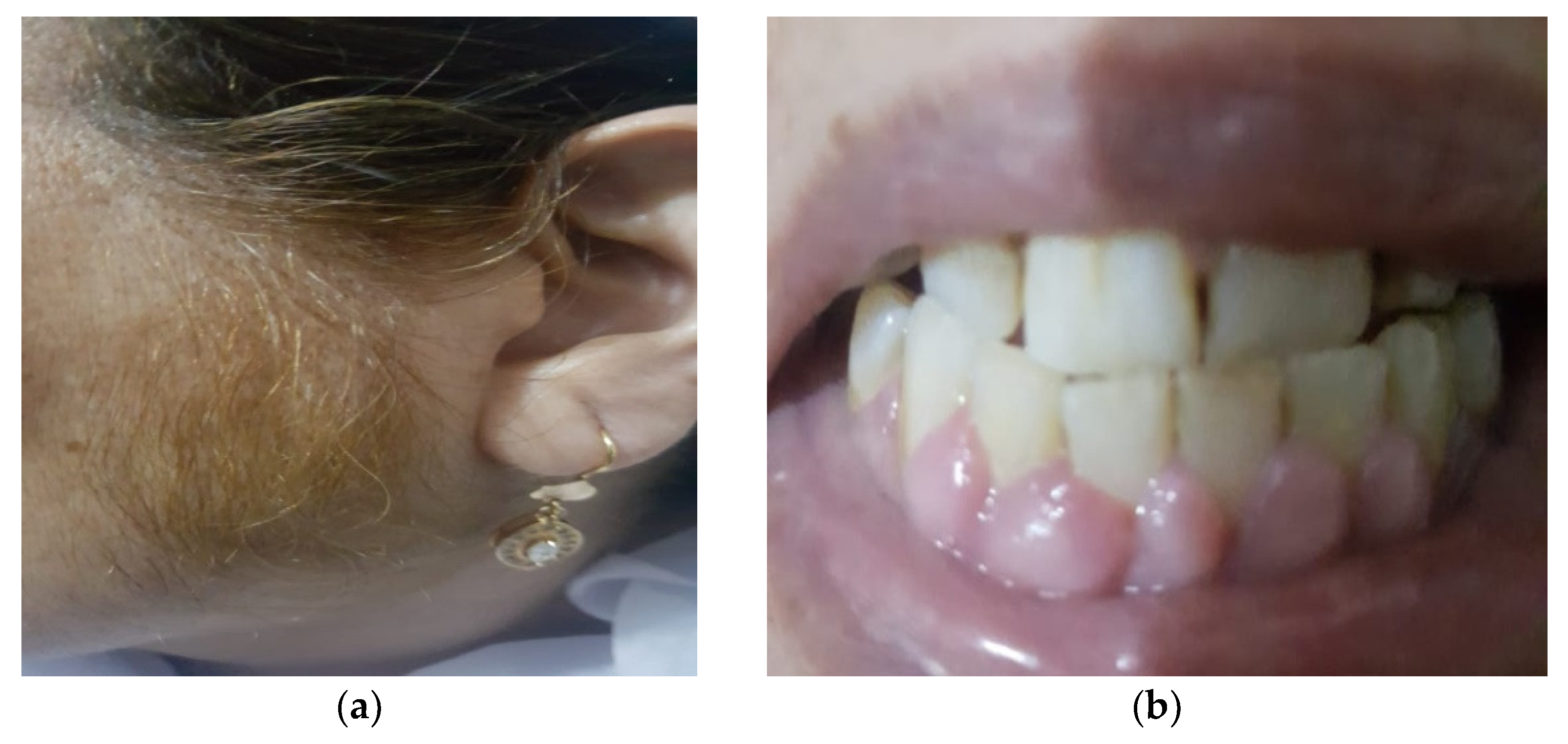 Uro 01 00018 g001 Uro 01 00018 g001