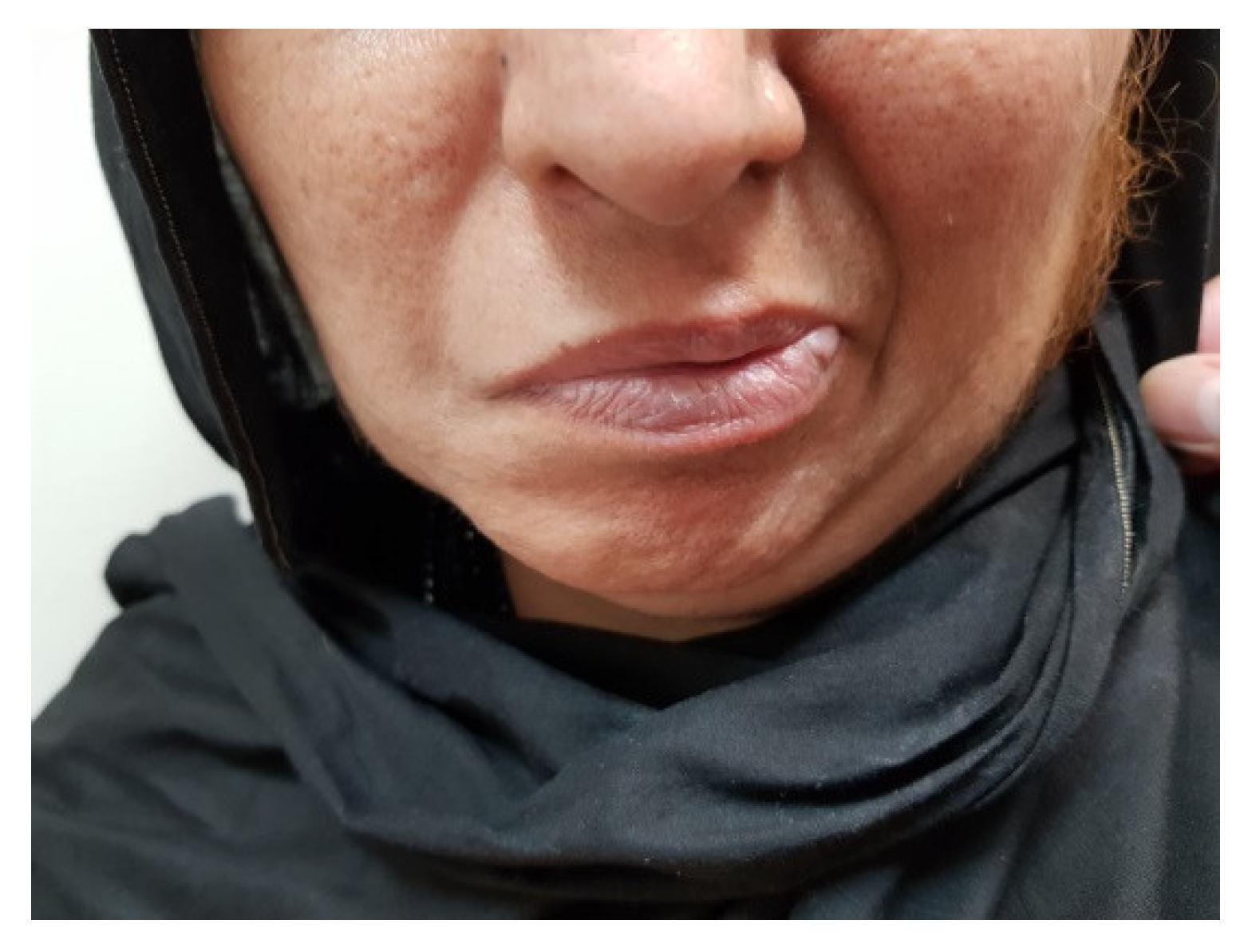 Uro 01 00018 g002 Uro 01 00018 g002