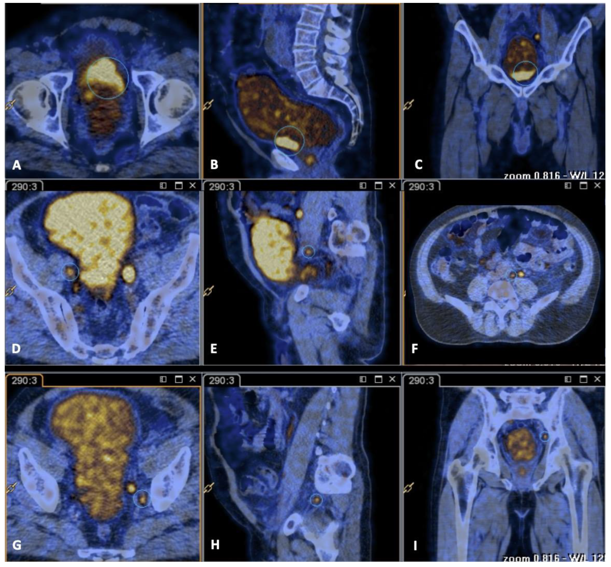 Uro 02 00002 g002 Uro 02 00002 g002